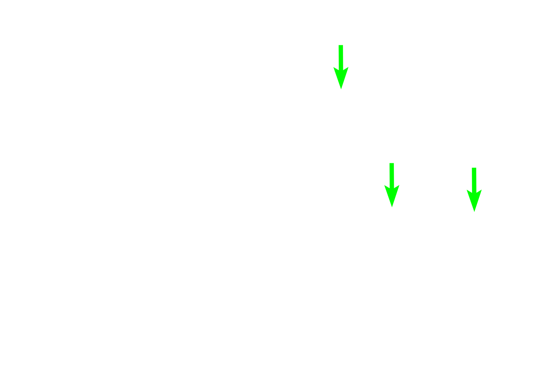  - Secretory granules (mucus) <p>Tubules, as the name indicates, are linear secretory units lined by cuboidal to columnar cells.  A number of tubules in longitudinal and cross section are visible in the image.  Most tubules secrete mucus and the apical region appears frothy or clear because the mucus is easily extracted during tissue processing.  The nuclei are basally located and compressed by the mass of mucus above them.  Tubules have a wide lumen to accommodate the thick, mucus secretion.</p>
