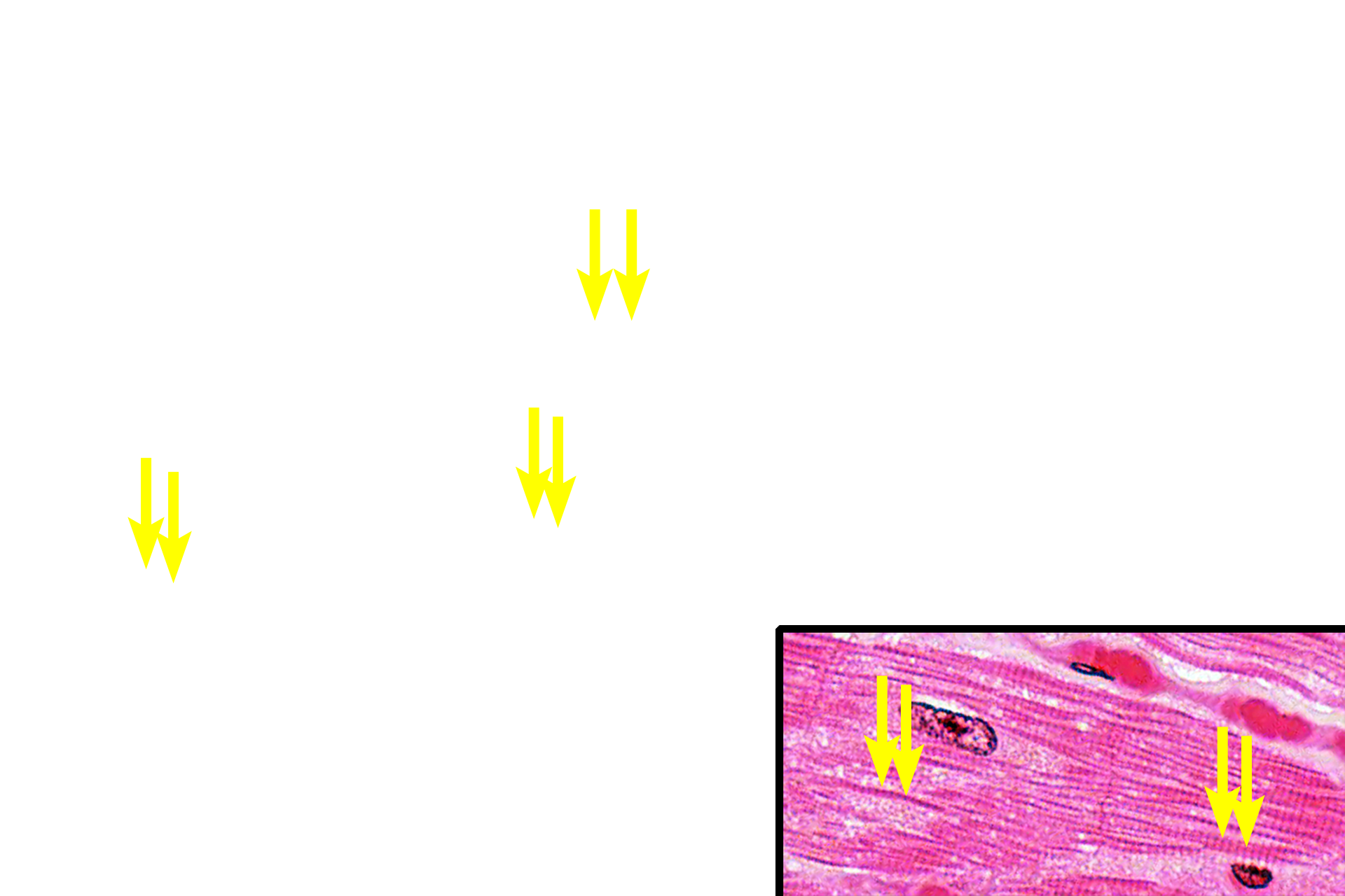  - Striations <p>Cardiac muscle fibers have fewer myofibrils compared with skeletal muscle fibers and thus their spacing allows them to be seen individually. The striations are evident along the length of each myofibril. Inset, 1000x</p>

