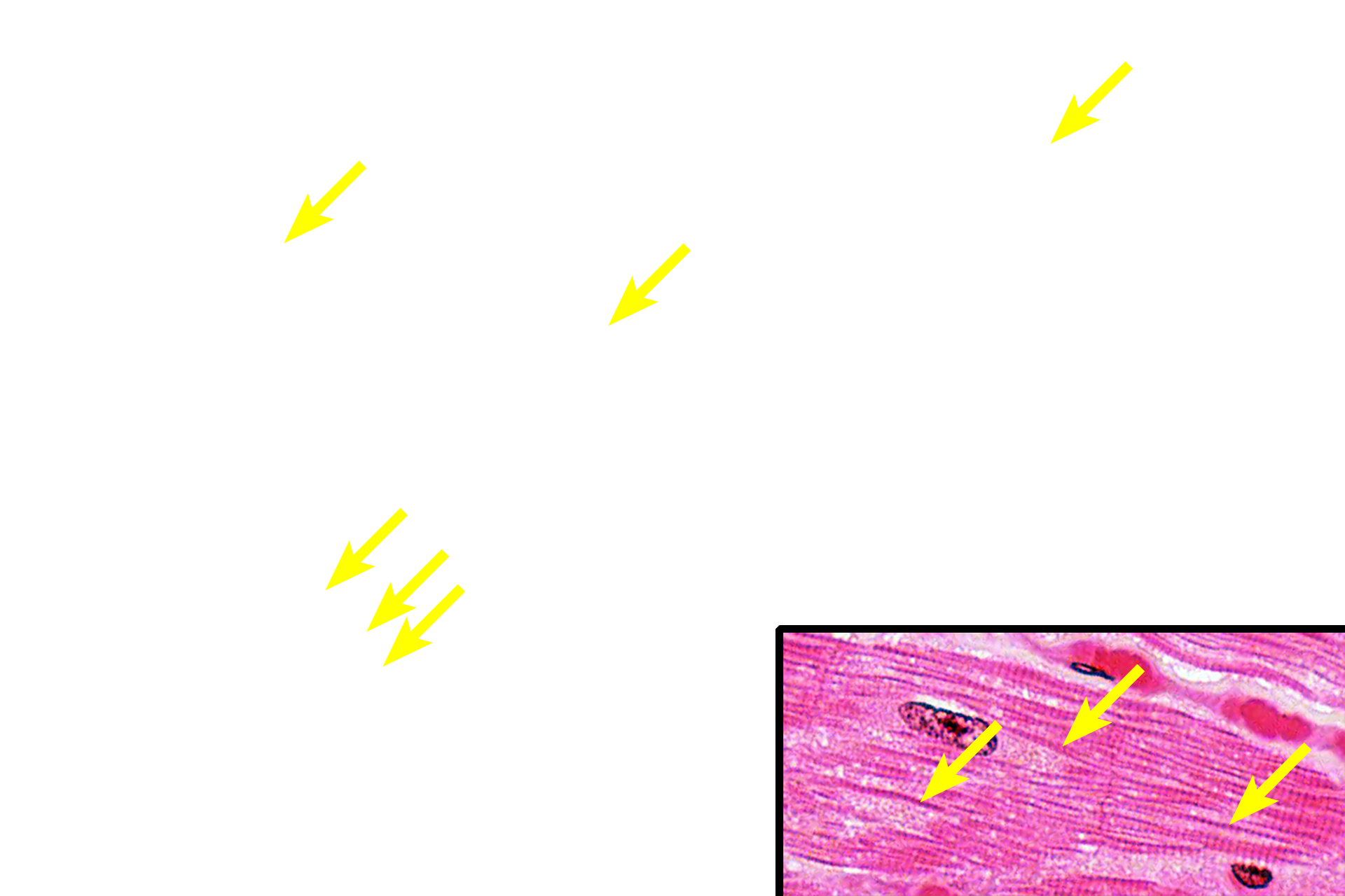 Myofibrils > <p>Cardiac muscle fibers have fewer myofibrils compared with skeletal muscle fibers and thus their spacing allows them to be seen individually. The striations are evident along the length of each myofibril. Inset, 1000x</p>
