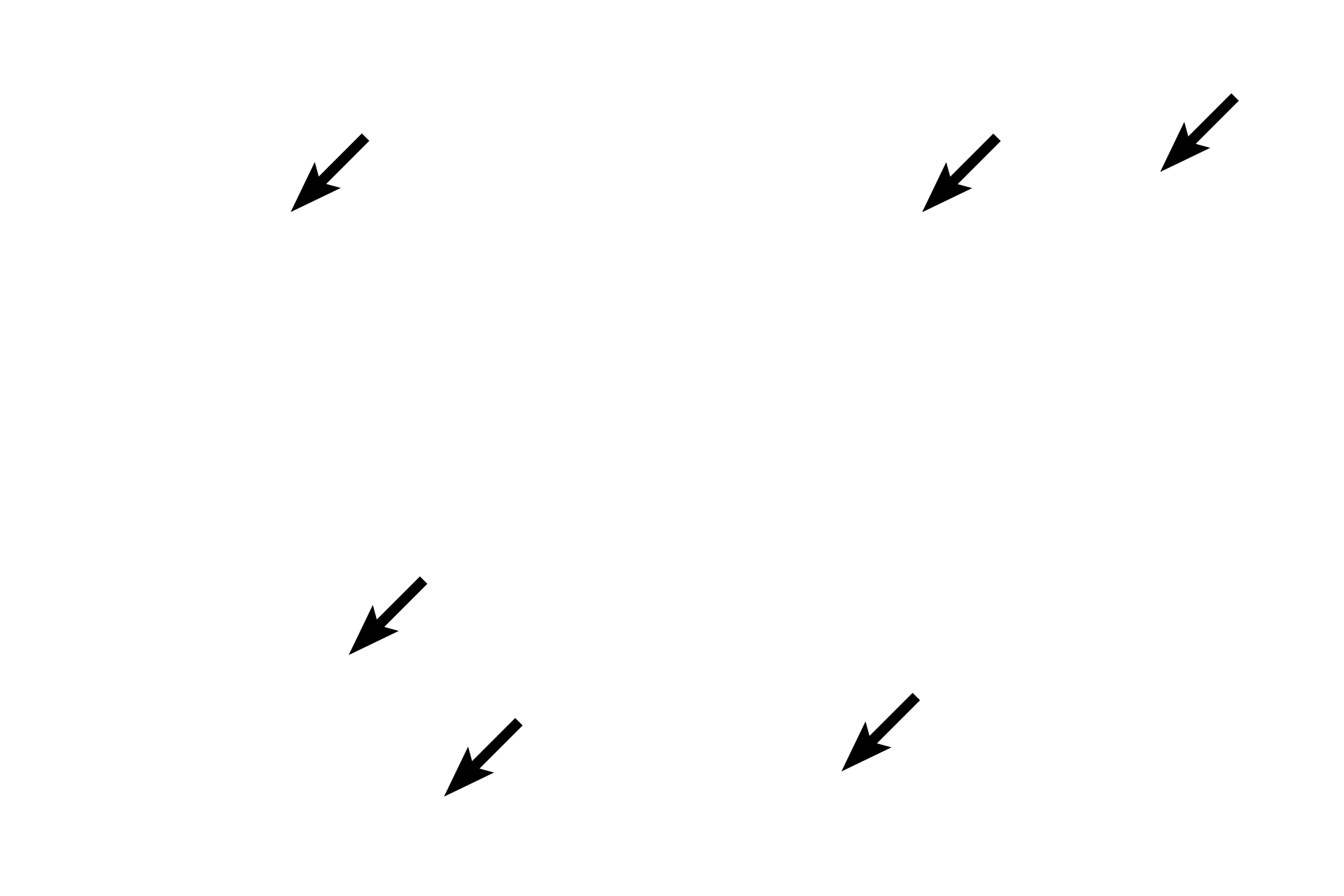  - Nuclei <p>Purkinje fibers often have two nuclei which are larger than regular cardiac muscle fibers.</p>
