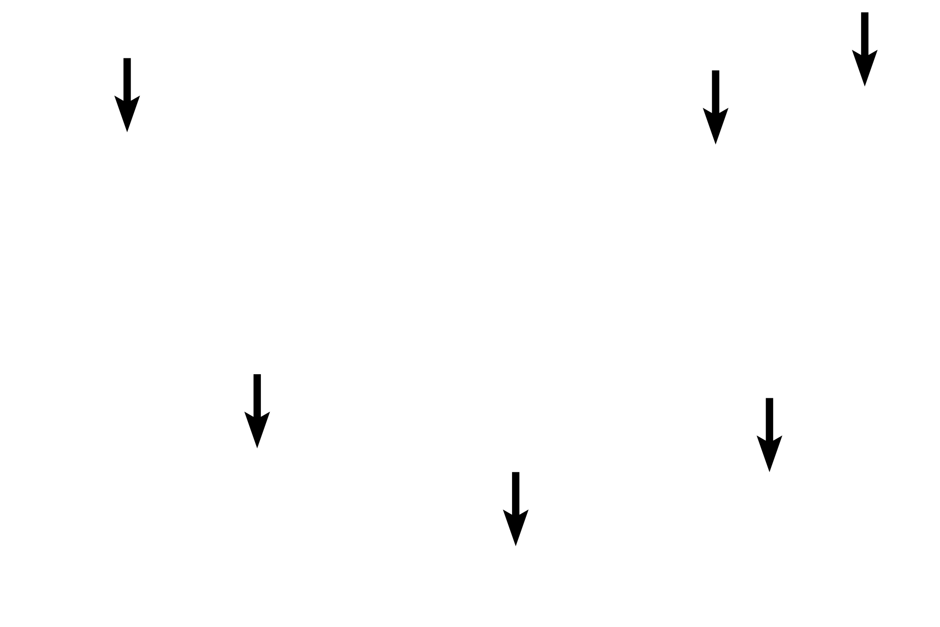  - Cytoplasm > <p>The cytoplasm of Purkinje fibers is very pale staining due to the presence of large amounts of glycogen.</p>
