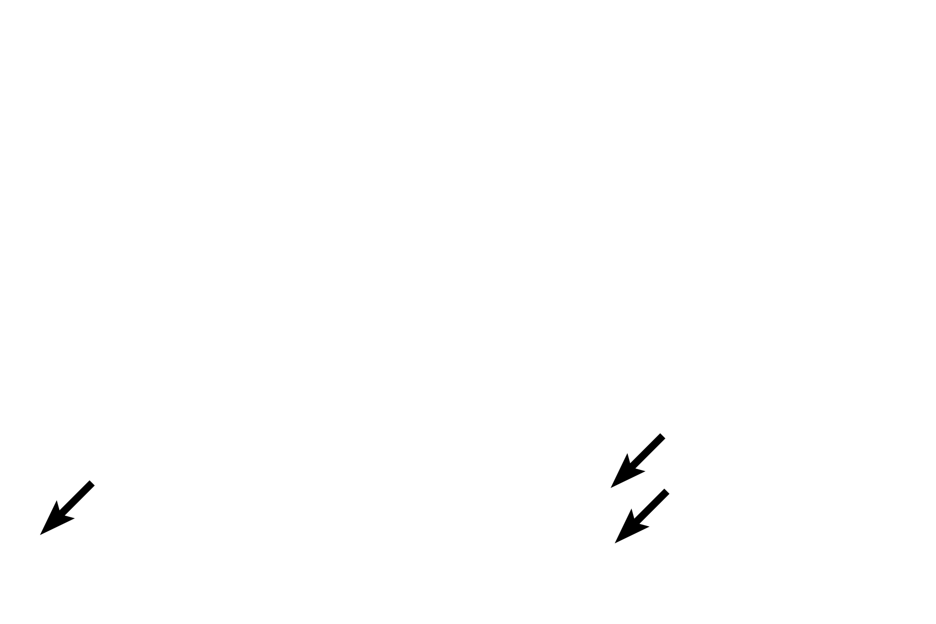  - Intercalated discs <p>Purkinje fibers are attached to each by intercalated discs.</p>
