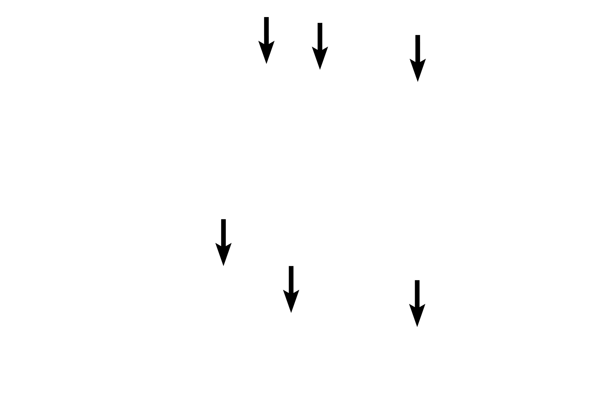 A bands > <p>The A band is the dark striation. In the lower image, a pale zone is visible in the center of the A band. This region is called the H band.</p>
