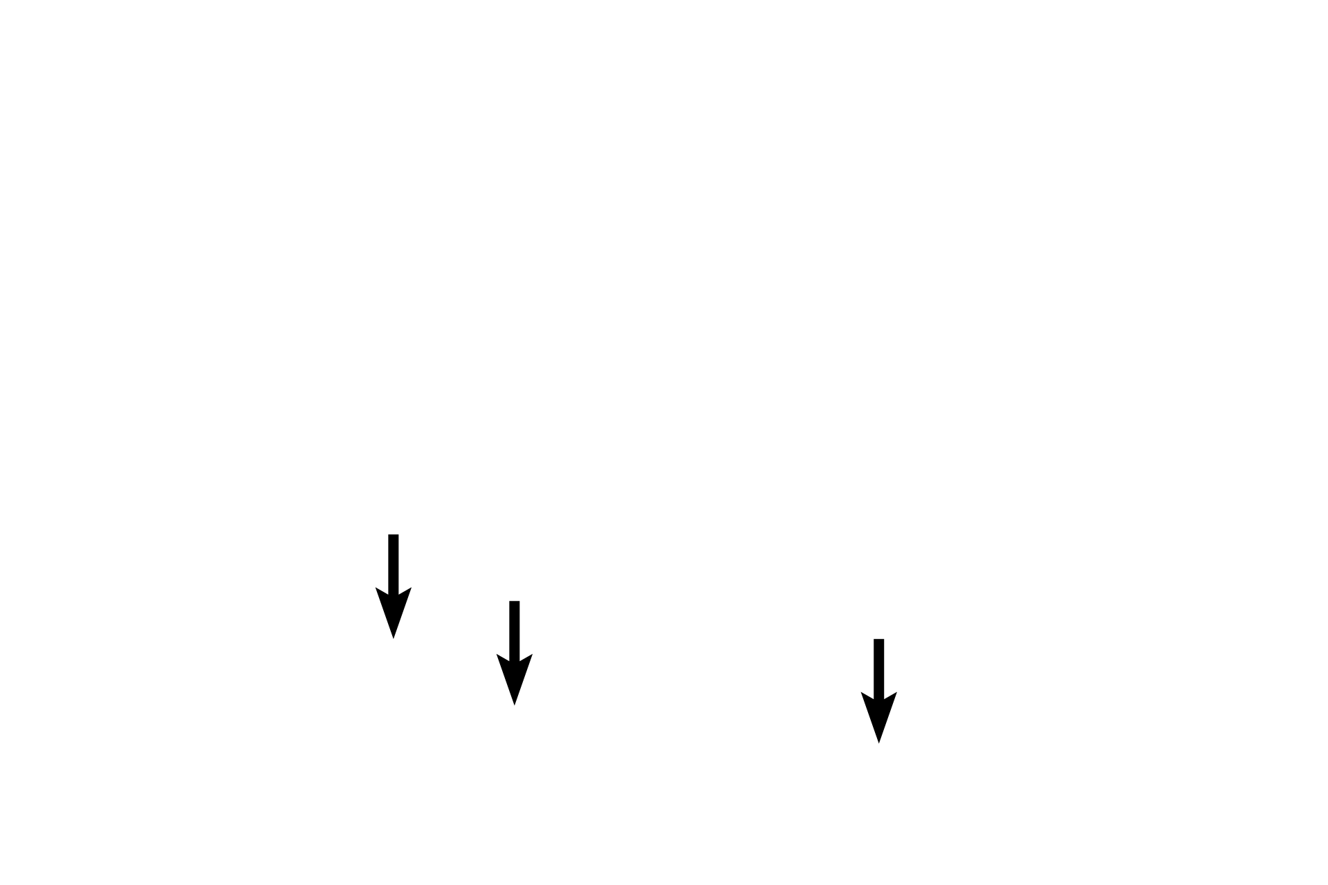  - Z lines > <p>The Z line is a thin band in the center of the I band. Z lines are are not visible in the upper, lower magnification image.</p>
