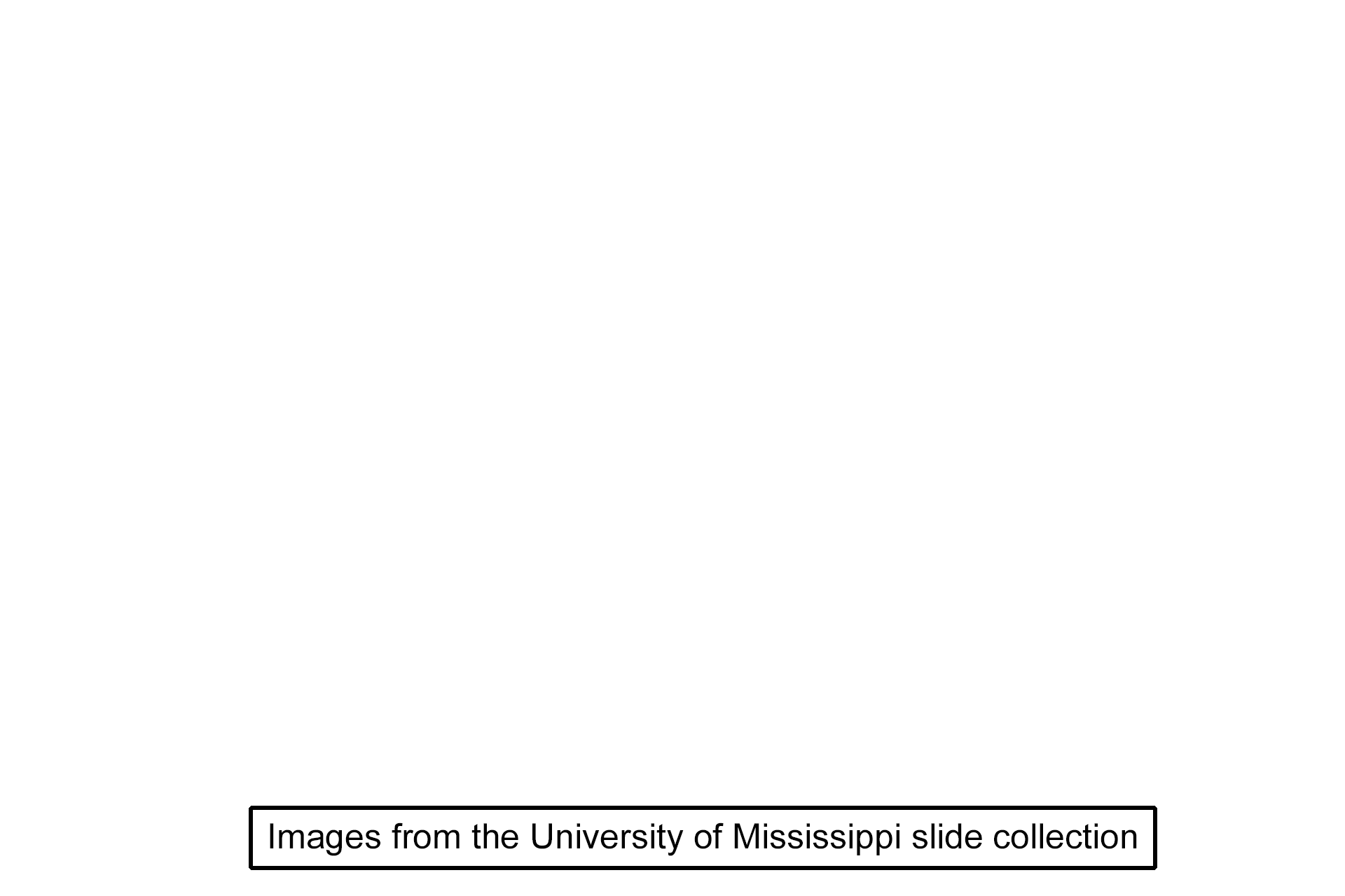 Image source > <p>These images were taken of a slide from the University of Mississippi slice collection.</p>
