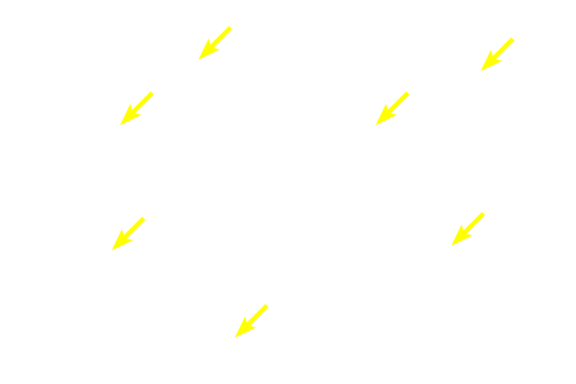 Multipolar neurons <p>These multipolar neurons are located in an autonomic ganglion in the sympathetic division of the autonomic nervous system.  Sympathetic ganglia are generally located at some distance from the organs they innervate and contain large numbers of both incoming preganglionic axons as well as exiting, efferent postganglionic axons from the multipolar neurons.  The neuron cell bodies are widely dispersed and extend numerous dendrites.  Eccentrically-located nuclei are common.  Satellite Schwann cells surround each neuronal in the ganglion.  Their cytoplasmic processes form a capsule around the cell body. 100x, 1000x</p>
