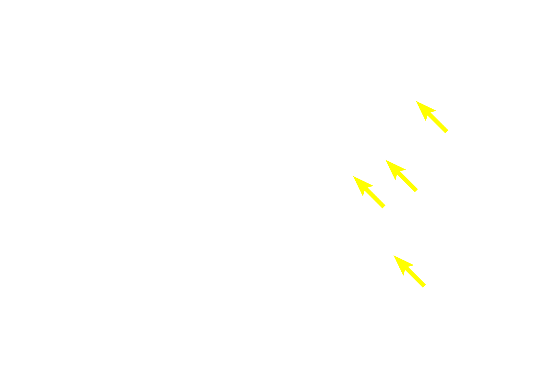 Dendrites <p>These multipolar neurons are located in an autonomic ganglion in the sympathetic division of the autonomic nervous system.  Sympathetic ganglia are generally located at some distance from the organs they innervate and contain large numbers of both incoming preganglionic axons as well as exiting, efferent postganglionic axons from the multipolar neurons.  The neuron cell bodies are widely dispersed and extend numerous dendrites.  Eccentrically-located nuclei are common.  Satellite Schwann cells surround each neuronal in the ganglion.  Their cytoplasmic processes form a capsule around the cell body. 100x, 1000x</p>
