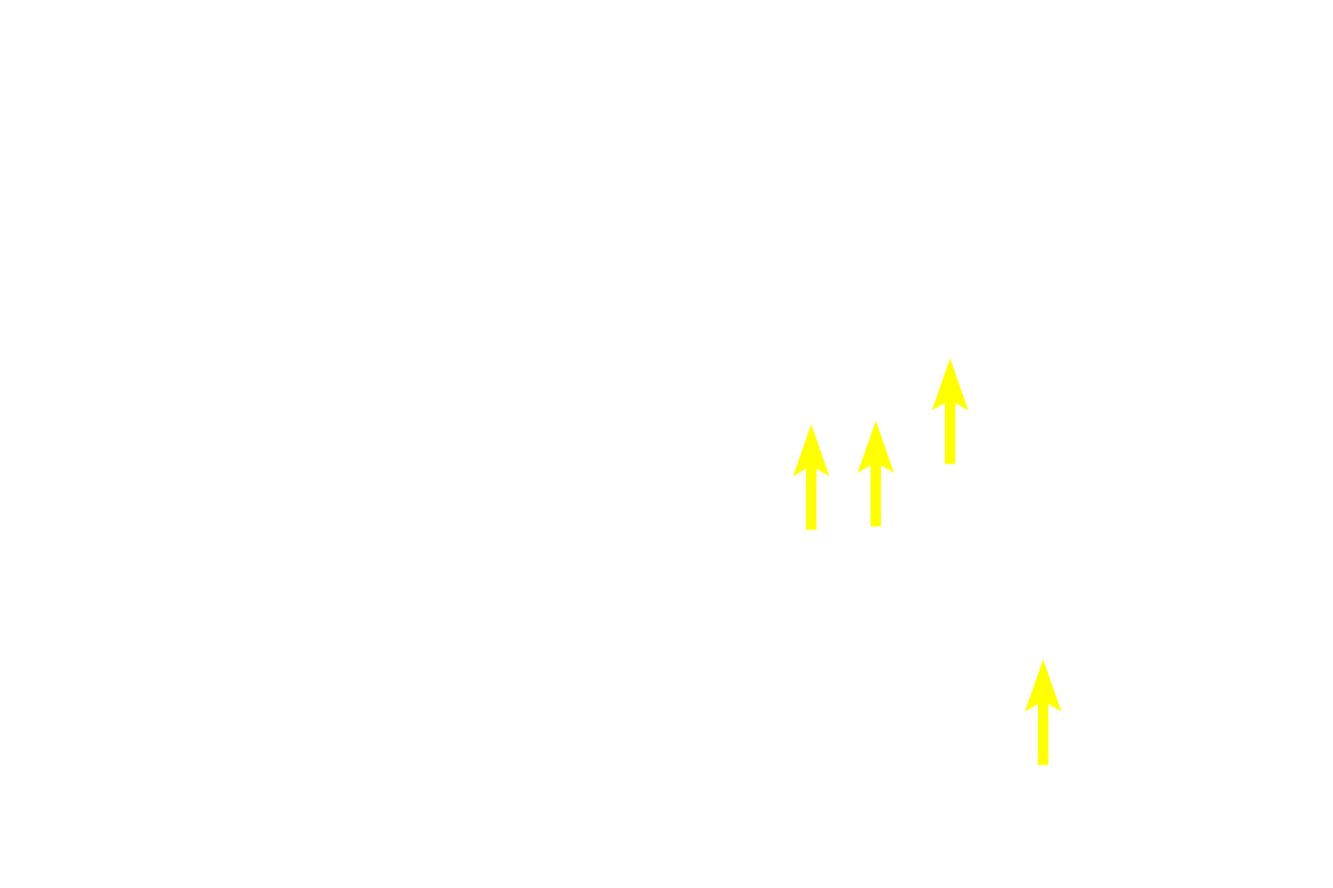Schwann cells <p>These multipolar neurons are located in an autonomic ganglion in the sympathetic division of the autonomic nervous system.  Sympathetic ganglia are generally located at some distance from the organs they innervate and contain large numbers of both incoming preganglionic axons as well as exiting, efferent postganglionic axons from the multipolar neurons.  The neuron cell bodies are widely dispersed and extend numerous dendrites.  Eccentrically-located nuclei are common.  Satellite Schwann cells surround each neuronal in the ganglion.  Their cytoplasmic processes form a capsule around the cell body. 100x, 1000x</p>
