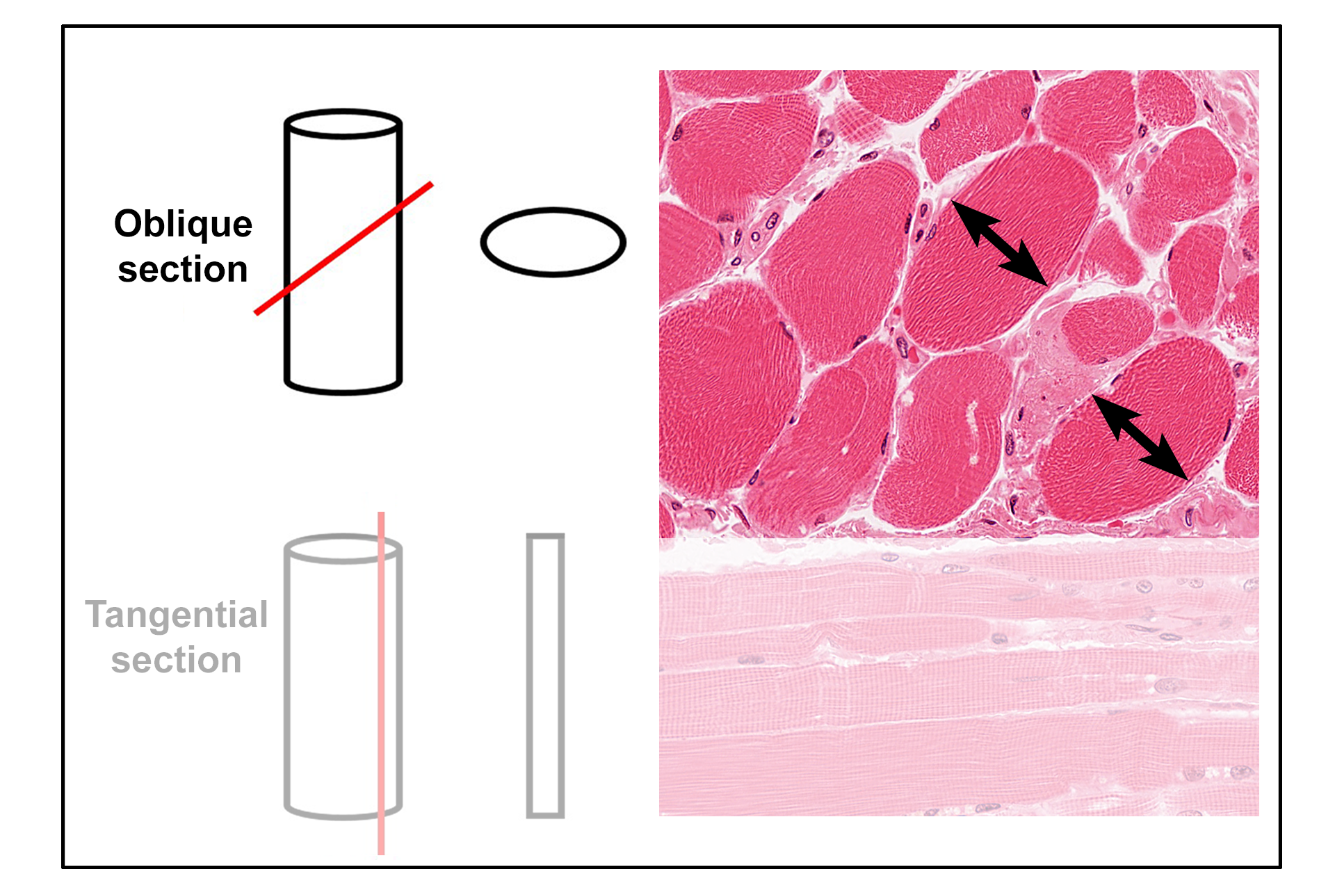  - Oblique section >  <p>An oblique section is a slice through a structure in a plane that is other than parallel or perpendicular to the longest axis of the structure.  In this example, a cylindrical structure will appear oval in section.  Examples of obliquely-sectioned skeletal muscle fibers are indicated.  </p>
