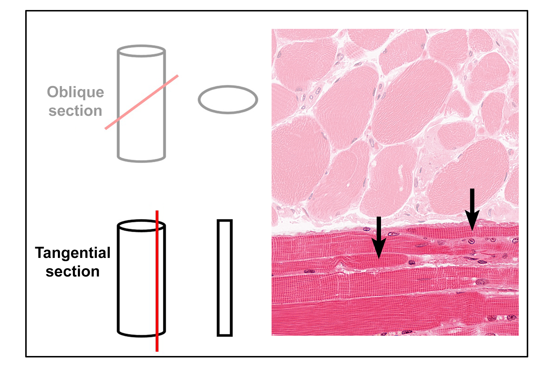  - Tangential section > <p>A tangential section is a slice that only superficially cuts through the surface of a structure. In this example, a broad cylindrical structure will appear much thinner in section.  Examples of tangentially-sectioned skeletal muscle fibers are indicated.  </p>
