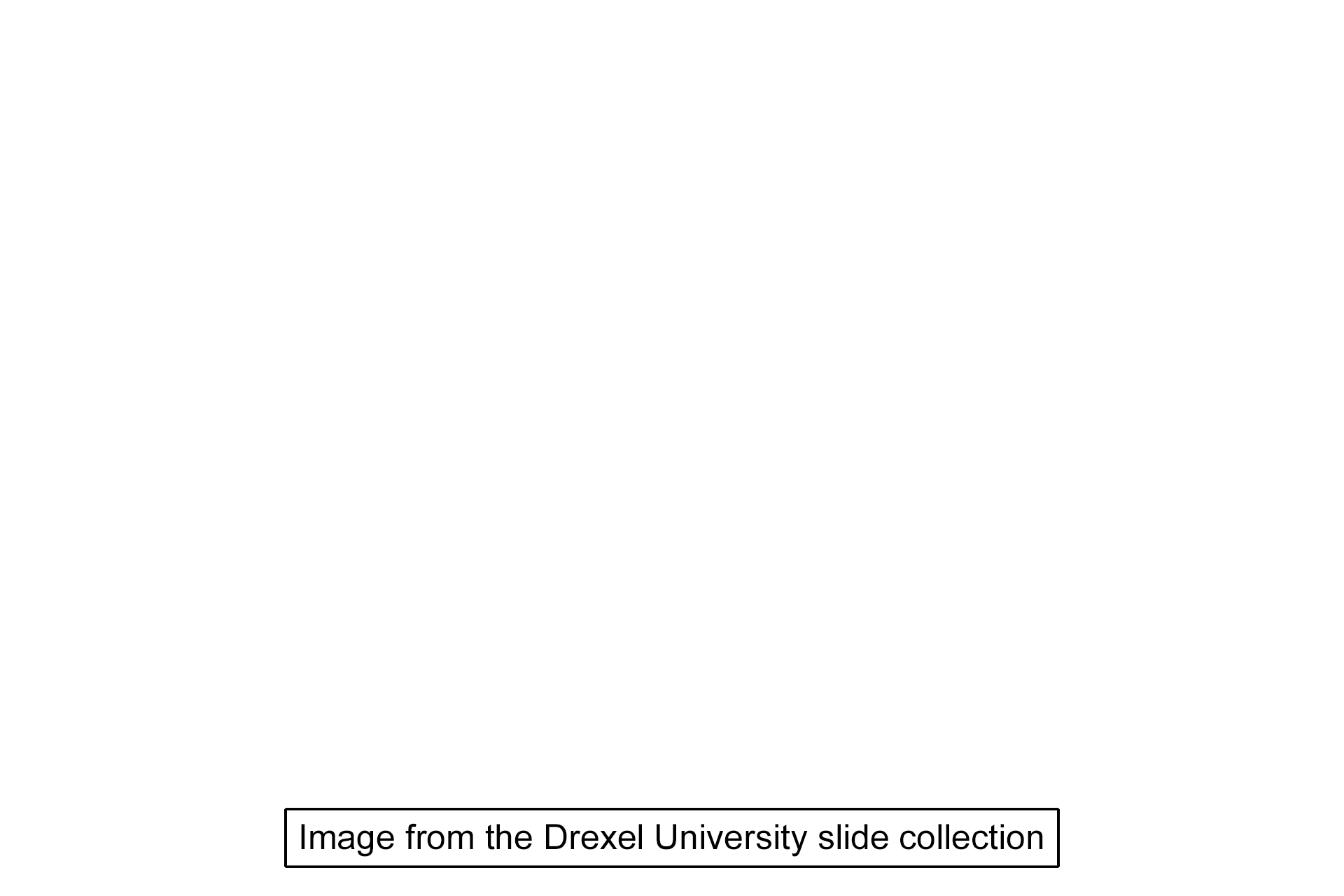 Image source > <p>This image was taken of a slide from the Drexel University slide collection.</p>
