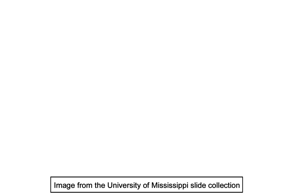 Image source > <p>This image was taken of a slide from the University of Mississippi slide collection.</p>
