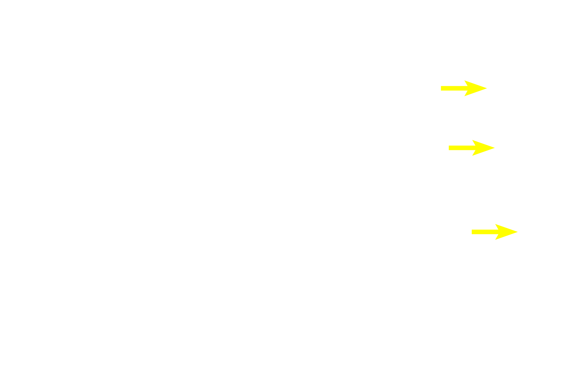 Spermatogonia <p>Spermatogenesis has four phases: spermatocytogenesis (mitotic division of spermatogonia to primary spermatocytes); meiosis (a two-step division of primary spermatocytes to secondary spermatocytes to spermatids); spermiogenesis (cytodifferentiation of spermatids into mature spermatozoa); and spermiation (the release of sperm from Sertoli cells). 600X</p>
