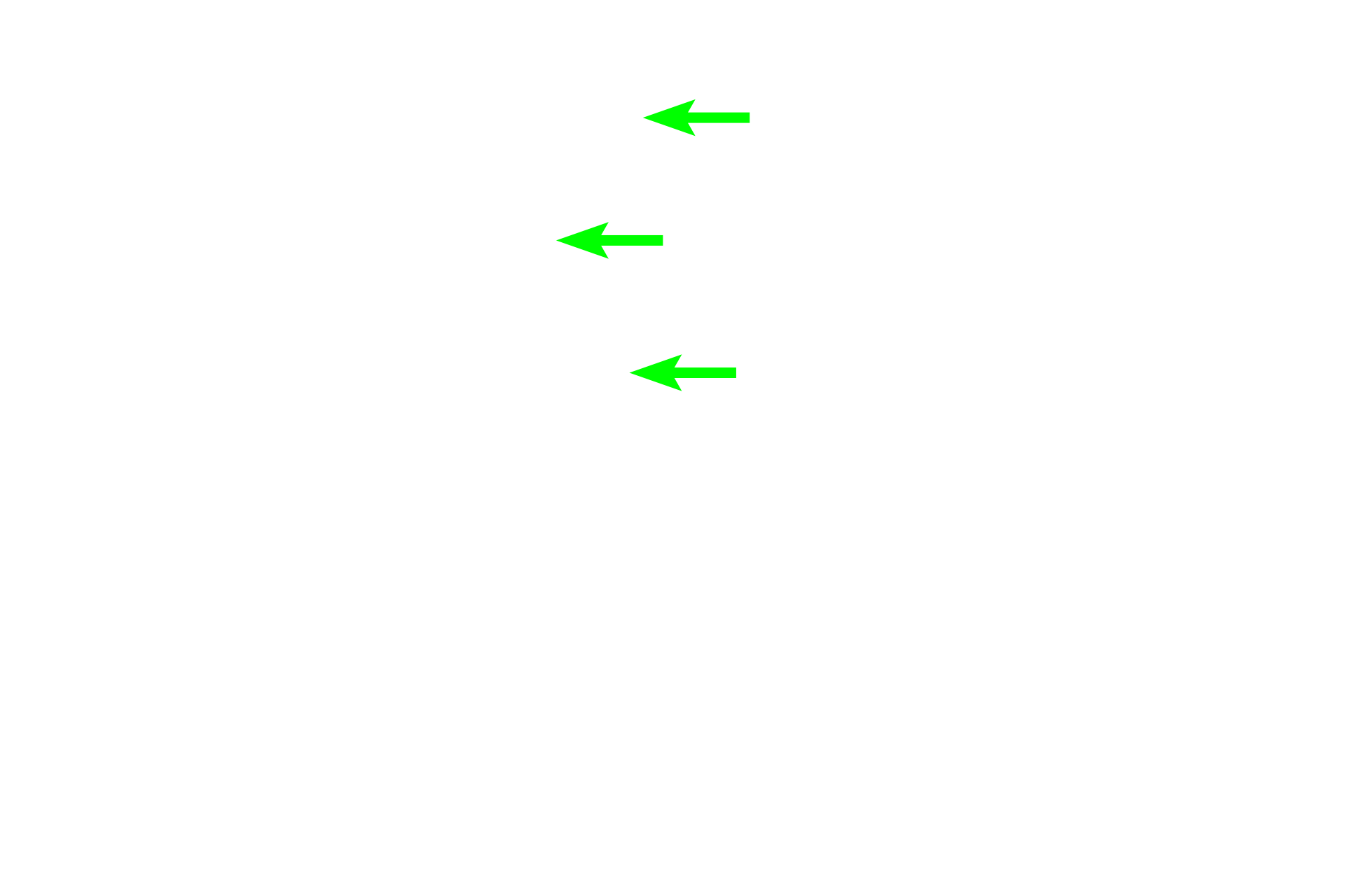 Spermatozoa <p>Spermatogenesis has four phases: spermatocytogenesis (mitotic division of spermatogonia to primary spermatocytes); meiosis (a two-step division of primary spermatocytes to secondary spermatocytes to spermatids); spermiogenesis (cytodifferentiation of spermatids into mature spermatozoa); and spermiation (the release of sperm from Sertoli cells). 600X</p>
