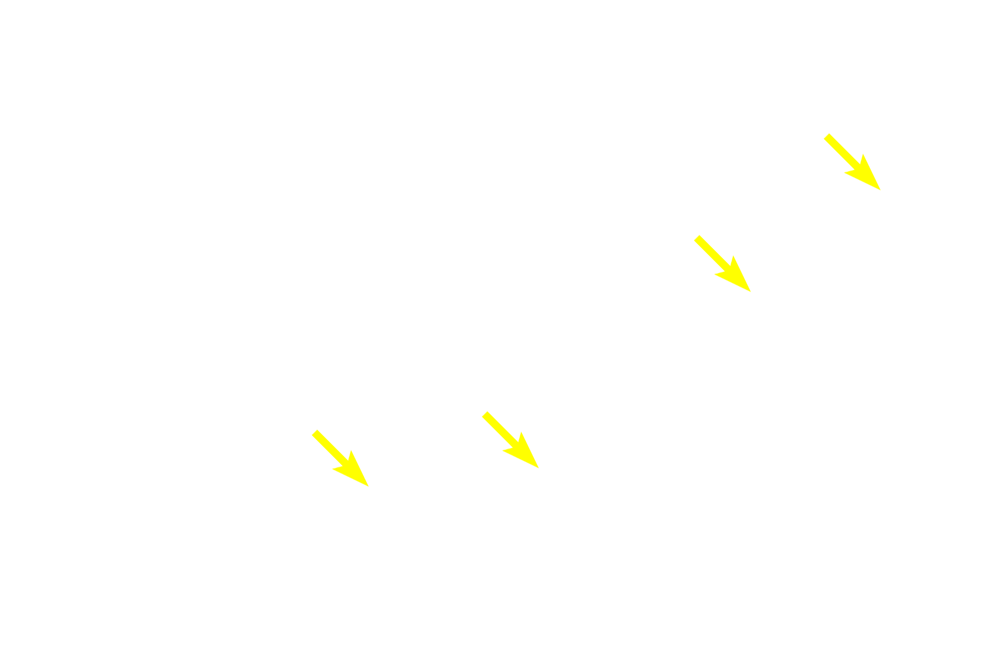 Myenteric (Auerbach's) plexus <p>This image shows the layers of the large intestine at higher magnification.  400x</p>
