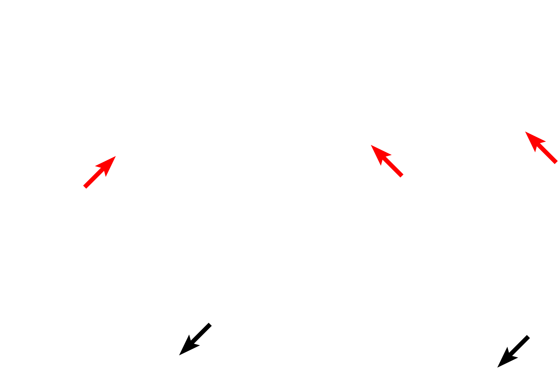 Serosa > <p>The outermost layer of the large intestine is either an adventitia or a serosa, depending on whether a particular segment of this organ is located intra- or retroperitoneally.</p>
