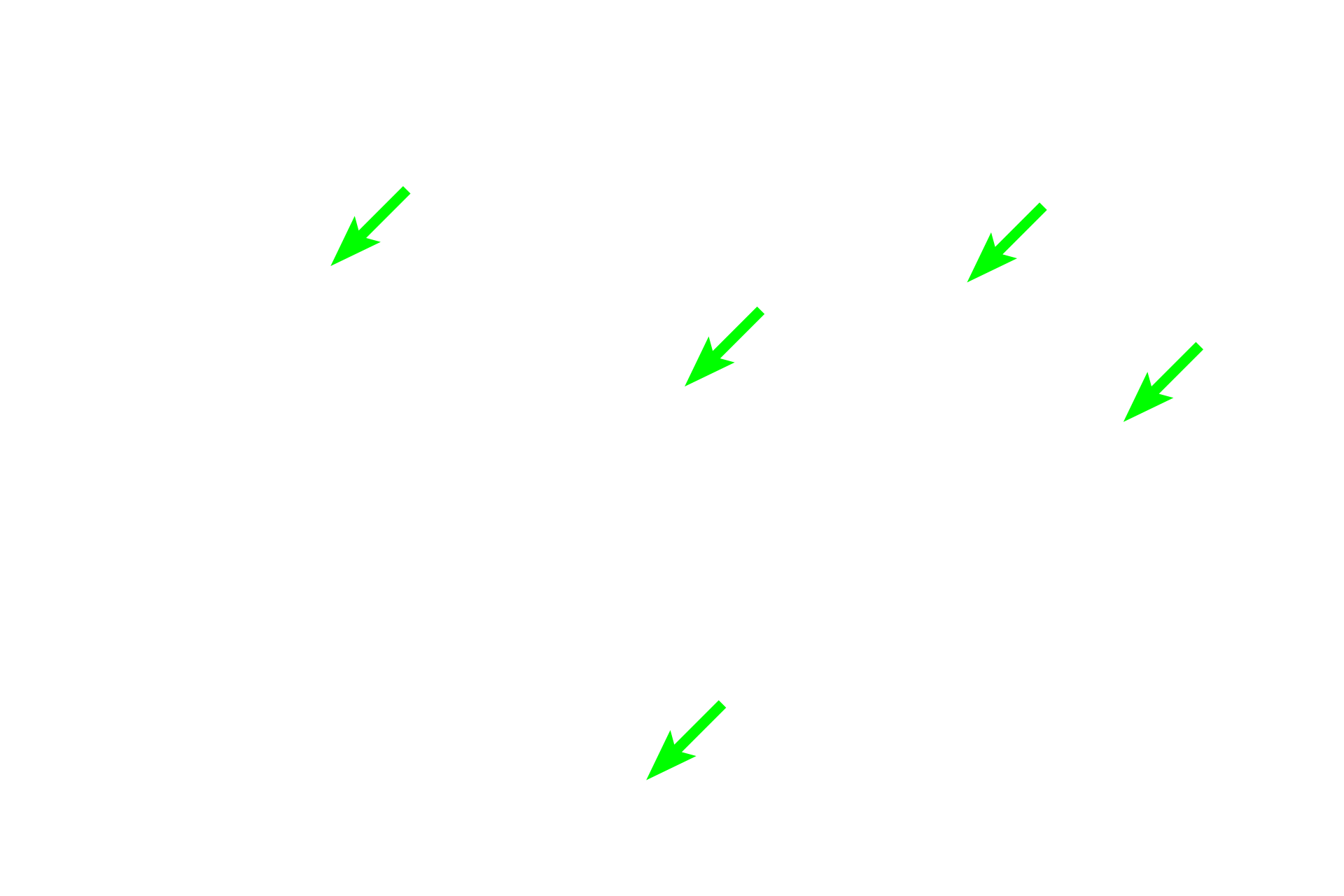 Spermatoza <p>The body and tail of the epididymis are filled with the highly coiled duct of the epididymis.  Numerous sectioned profiles of the single duct are seen in this image.  The duct is lined by a very tall, regular, pseudostratified columnar epithelium with stereocilia, beneath which is layer of smooth muscle.  As the duct progresses from the head to the tail region, its epithelium decreases in height and the smooth muscle layer increases in thickness.  40x    </p>
