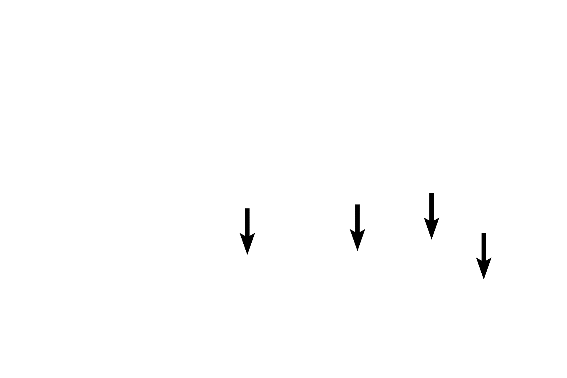 Rete testis <p>At the posterior margin of the immature testis, the connective tissue forming tunica albuginea thickens and protrudes into the testis, forming the mediastinum. The mediastinum contains the rete testis, the beginning of the ducts that transport sperm out of the testis. A tunica vaginalis is lacking posteriorly because the testis develops as a retroperitoneal structure.  Immature testis, 100x</p>
