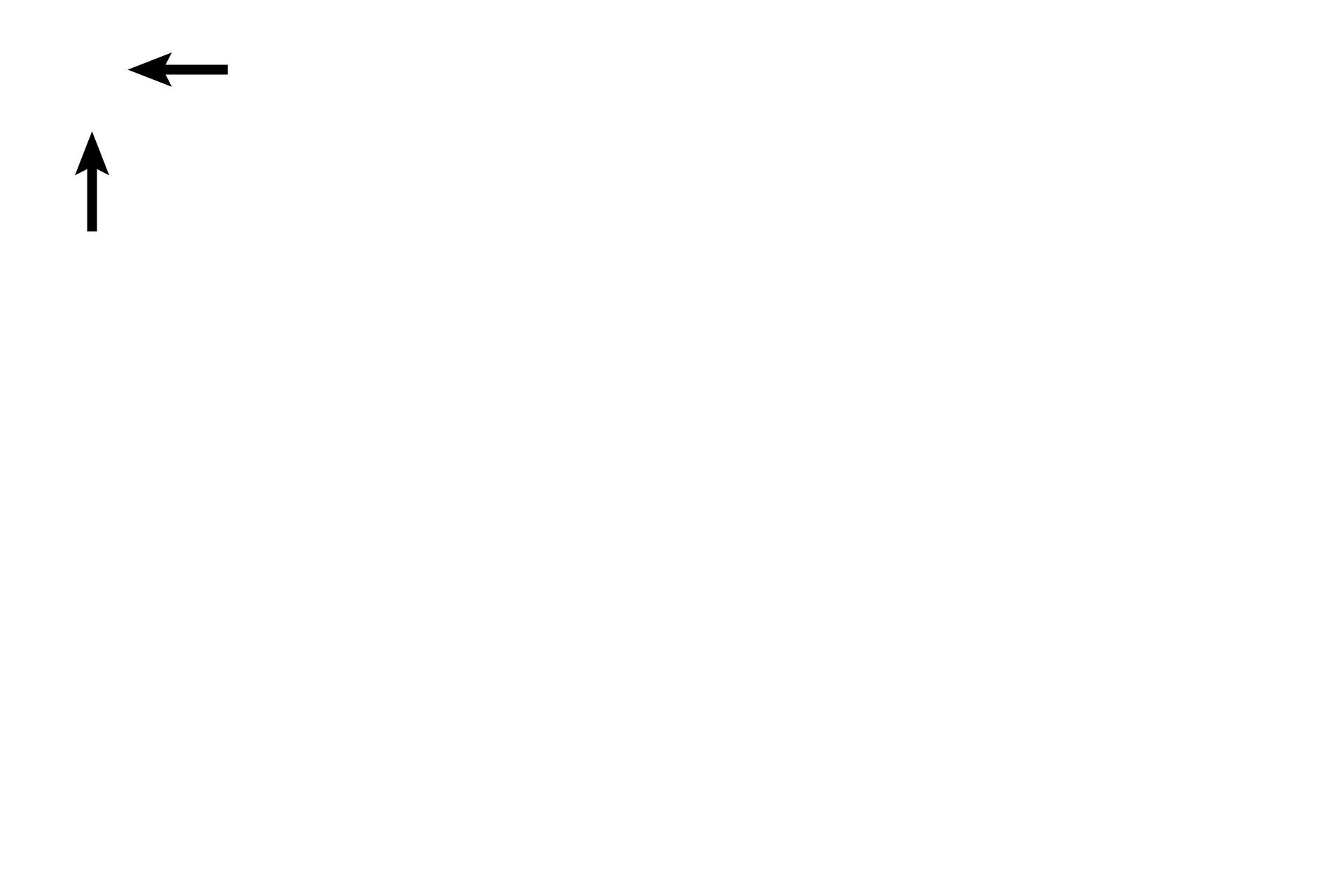 Efferent ductules <p>Sperm pass from the seminiferous tubules into the rete testis, an interconnected system of channels located in the mediastinum.  The rete, in turn, connect with about 20 efferent ductules, transporting sperm out of the testis and terminating at the duct of the epididymis in the head of the epididymis.  40x</p>
