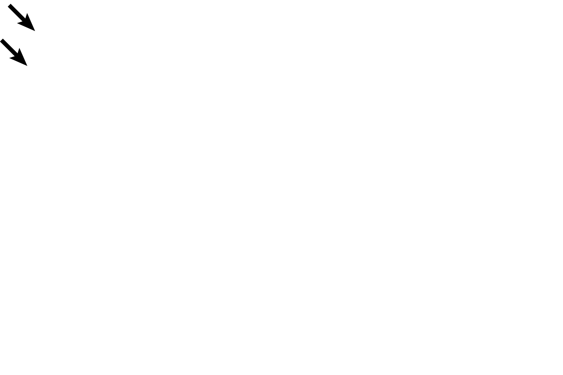 Duct of epididymis <p>Sperm pass from the seminiferous tubules into the rete testis, an interconnected system of channels located in the mediastinum.  The rete, in turn, connect with about 20 efferent ductules, transporting sperm out of the testis and terminating at the duct of the epididymis in the head of the epididymis.  40x</p>
