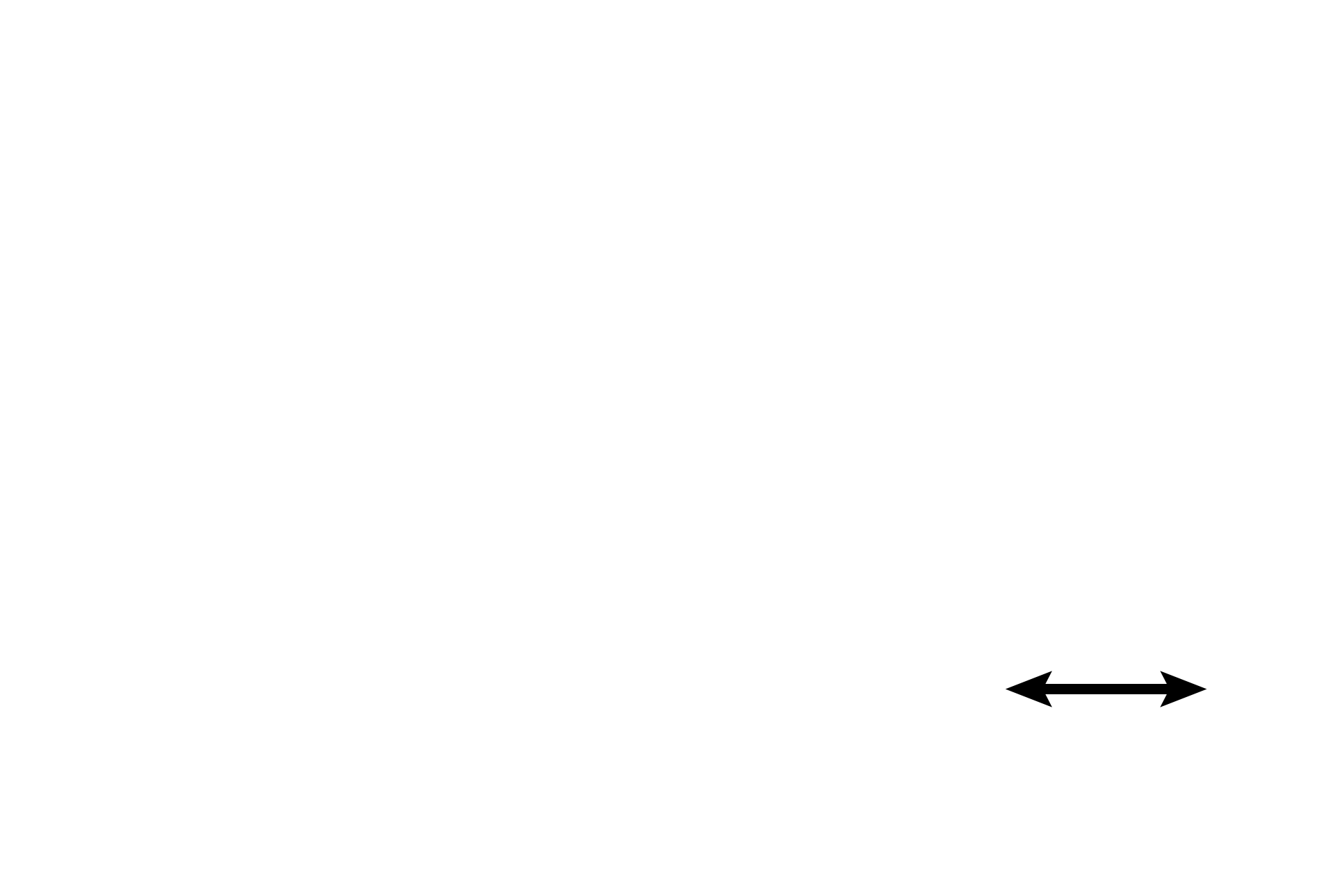 Rete testis <p>Changes in epithelium help to differentiate the intratesticular passages in the testis as seen in this transition region from convoluted portions of the seminiferous tubule to the rete testis. Stratified germinal epithelium lines the convoluted portion of the seminiferous tubules; simple columnar epithelium (modified Sertoli cells) lines the short straight portions of the seminiferous tubules; and simple cuboidal epithelium lines the rete testis. 400x</p>
