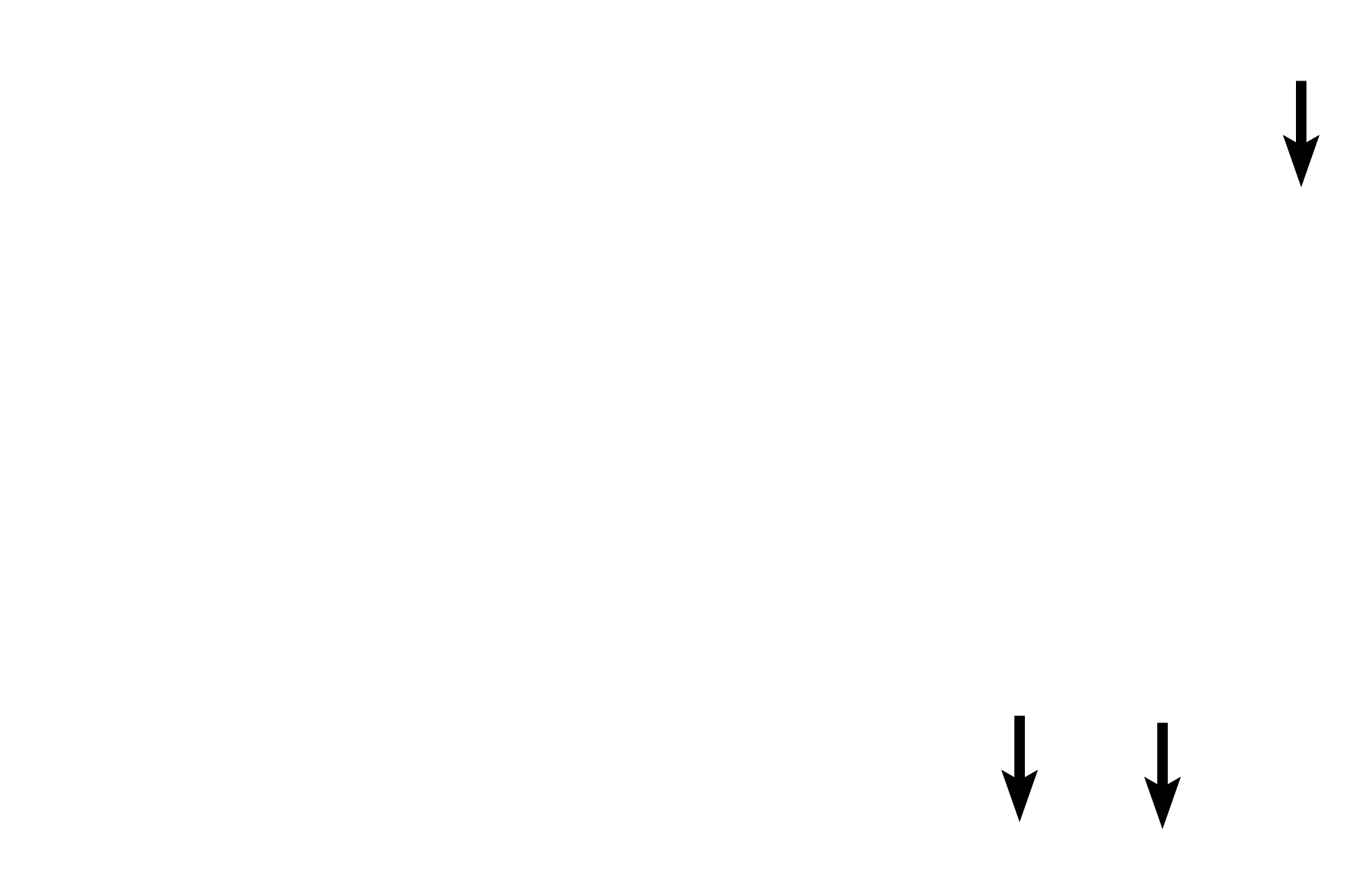 Central nuclei <p>Diagnostic features of cardiac muscle fibers are branching fibers, intercalated discs and centrally-located nuclei.  Intercalated discs, appearing as thick lines, are specialized junctions between fibers; each is composed of interdigitating plasma membranes (sarcolemmae), myofilaments and cell junctions.  400x</p>
