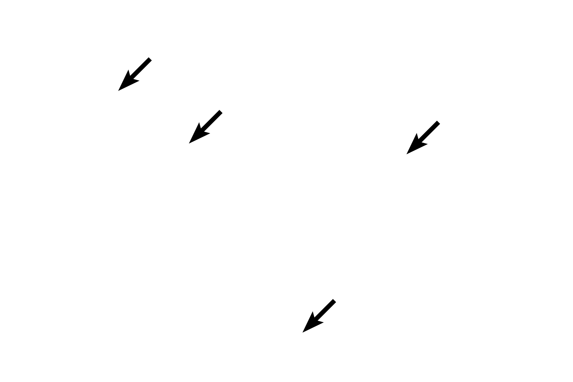 Intercalated discs <p>Diagnostic features of cardiac muscle fibers are branching fibers, intercalated discs and centrally-located nuclei.  Intercalated discs, appearing as thick lines, are specialized junctions between fibers; each is composed of interdigitating plasma membranes (sarcolemmae), myofilaments and cell junctions.  400x</p>
