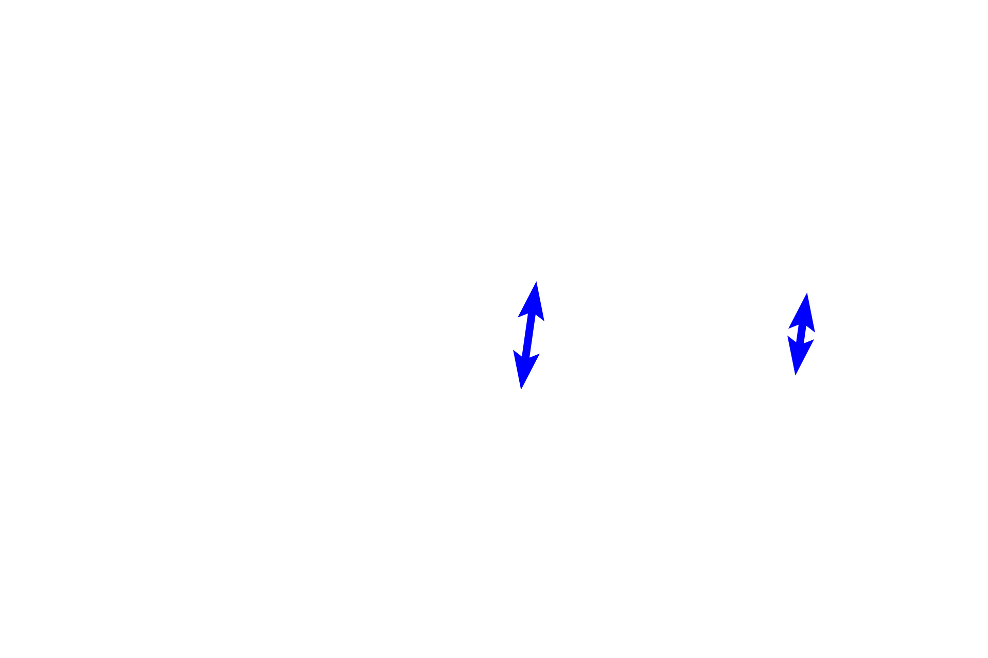  - Membranous portion <p>The interventricular septum, separating the two ventricles, consists of muscular and membranous portions.  Also shown are aortic and right atrioventricular valves, the cardiac skeleton and the conducting system (in blue).  The box in the left diagram shows the region where the micrograph (right) was taken; the central diagram is an illustration of the micrograph.  10x</p>
