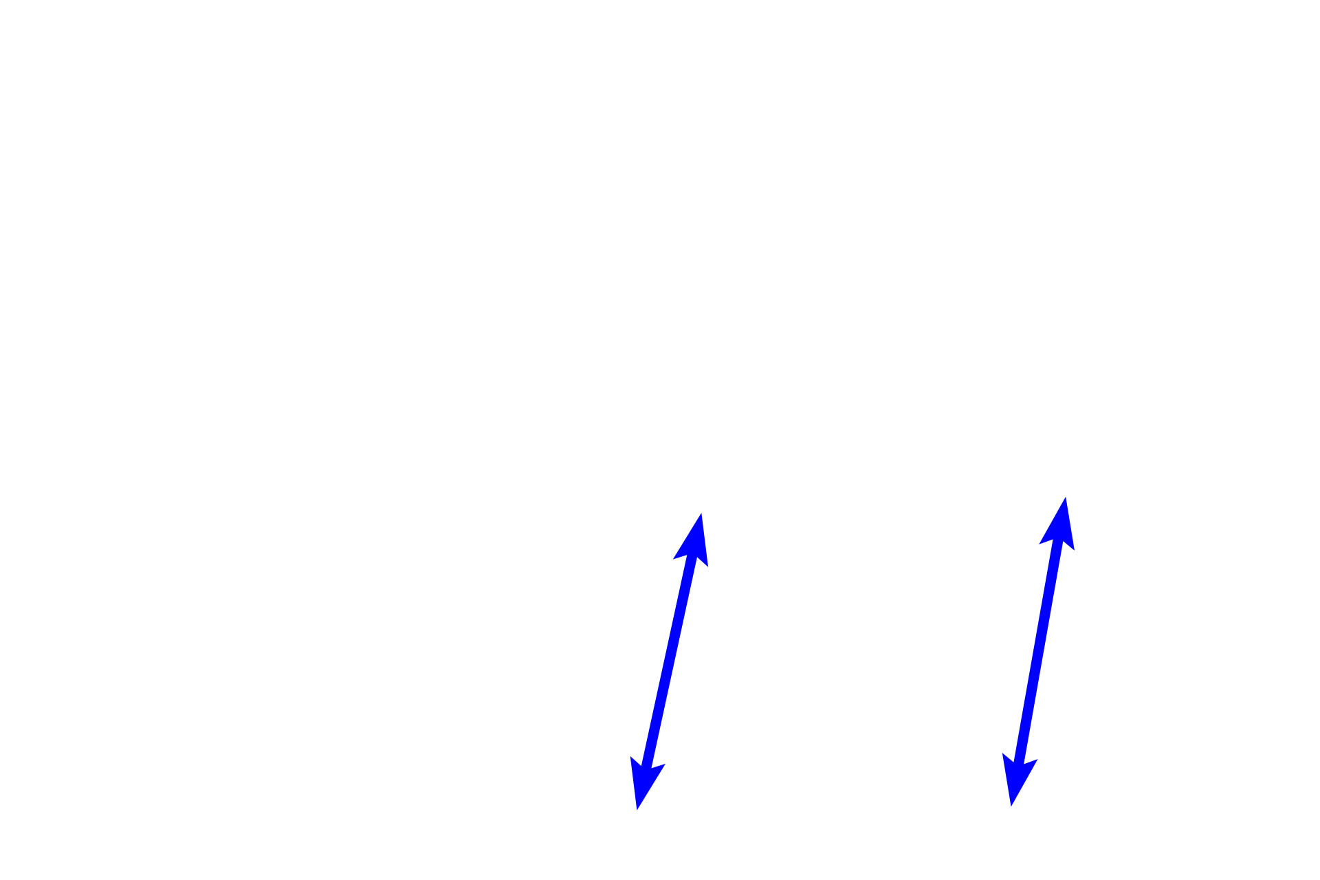  - Muscular portion <p>The interventricular septum, separating the two ventricles, consists of muscular and membranous portions.  Also shown are aortic and right atrioventricular valves, the cardiac skeleton and the conducting system (in blue).  The box in the left diagram shows the region where the micrograph (right) was taken; the central diagram is an illustration of the micrograph.  10x</p>
