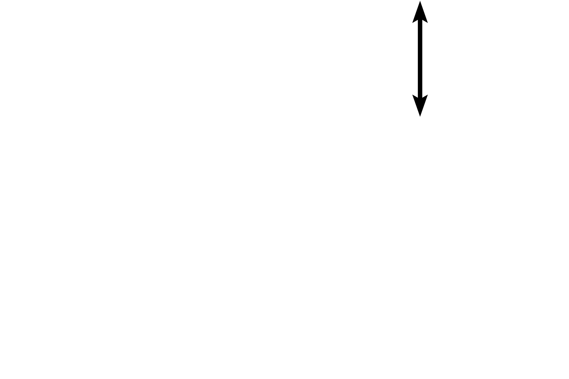  - Membranous portion  <p>The interventricular septum is formed by a membranous portion (septum membranaceum) of dense connective tissue and a muscular portion composed of cardiac muscle.</p>
