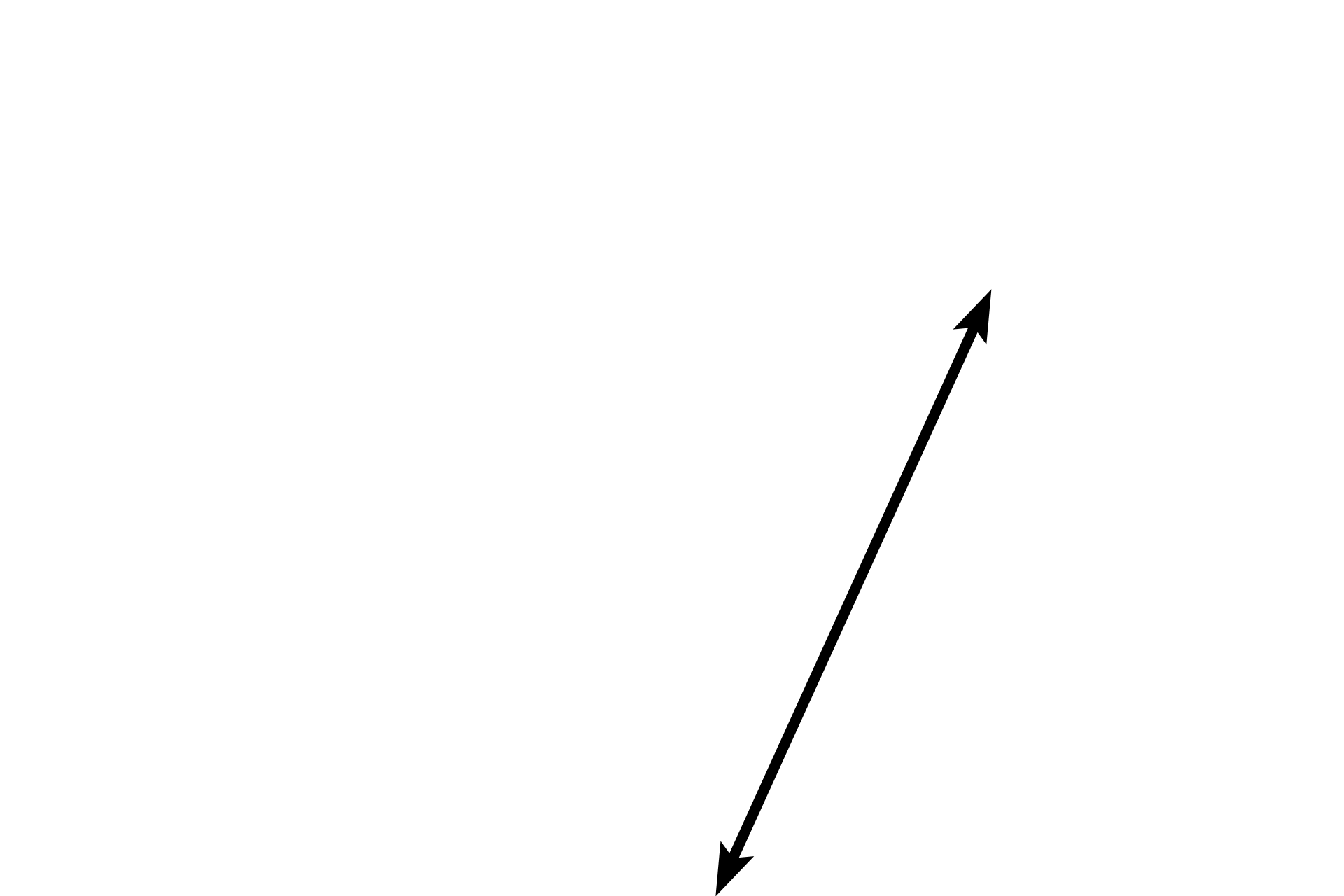  - Muscular portion  <p>The interventricular septum is formed by a membranous portion (septum membranaceum) of dense connective tissue and a muscular portion composed of cardiac muscle.</p>
