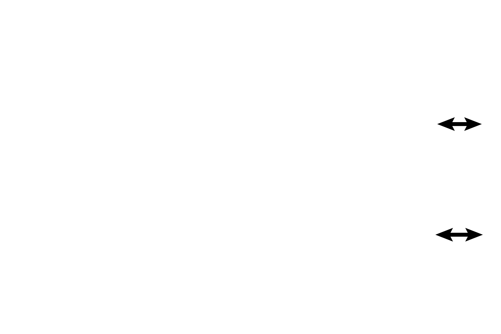  - Subendothelial connective tissue <p>The endocardium forms the inner layer of the heart and consists of an epithelium (endothelium), subendothelial connective tissue and a subendocardial layer.  Purkinje fibers are located in the subendocardial layer.</p>
