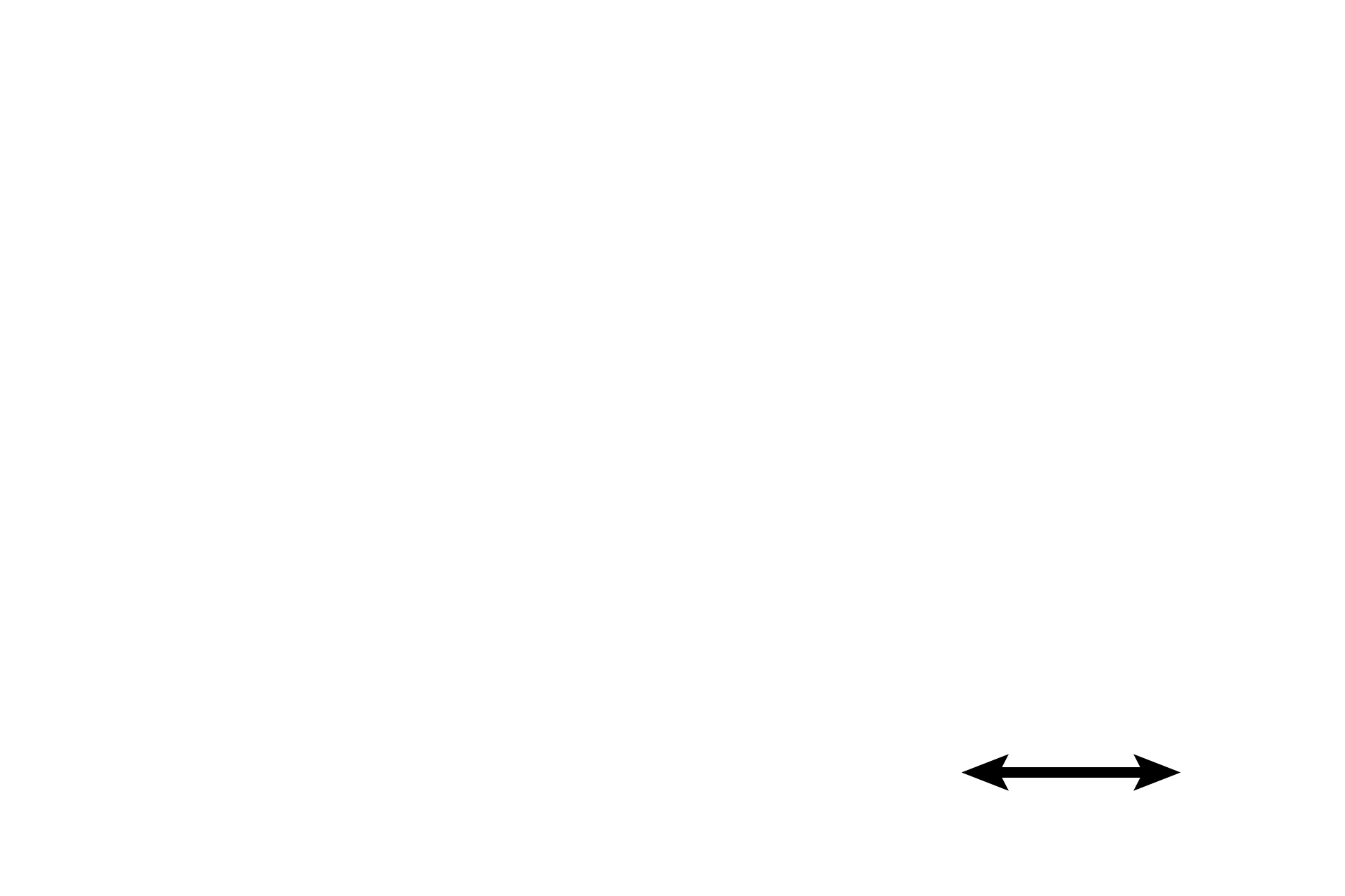  - Subendocardial layer <p>The endocardium forms the inner layer of the heart and consists of an epithelium (endothelium), subendothelial connective tissue and a subendocardial layer.  Purkinje fibers are located in the subendocardial layer.</p>
