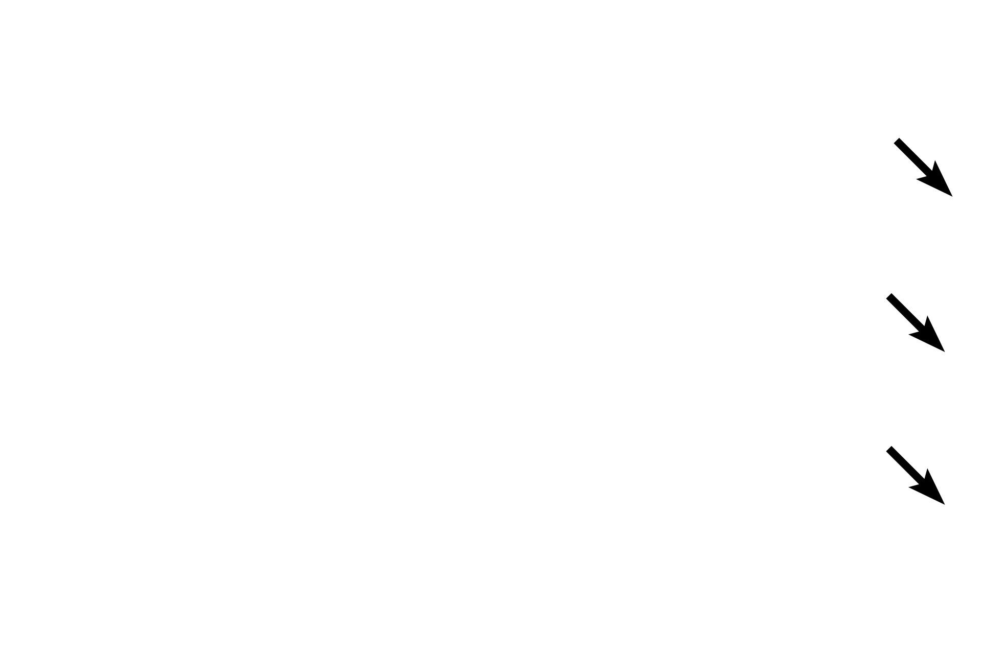  - Endothelium <p>The endocardium forms the inner layer of the heart and consists of an epithelium (endothelium), subendothelial connective tissue and a subendocardial layer.  Purkinje fibers are located in the subendocardial layer.</p>
