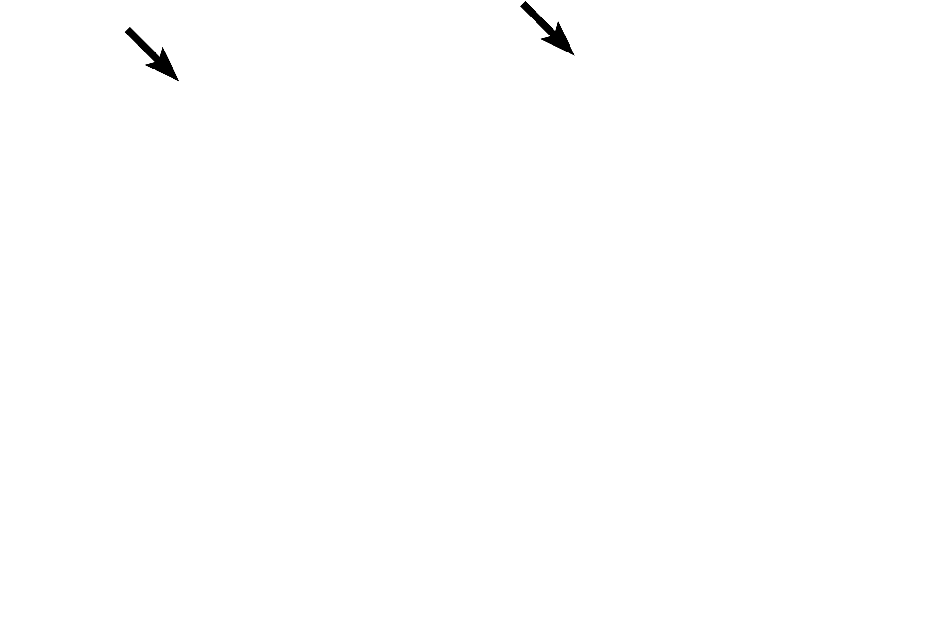  - Endothelium <p>The endocardium forms the inner lining of the heart chambers. The space within the chamber is located at the top of the image.</p>
