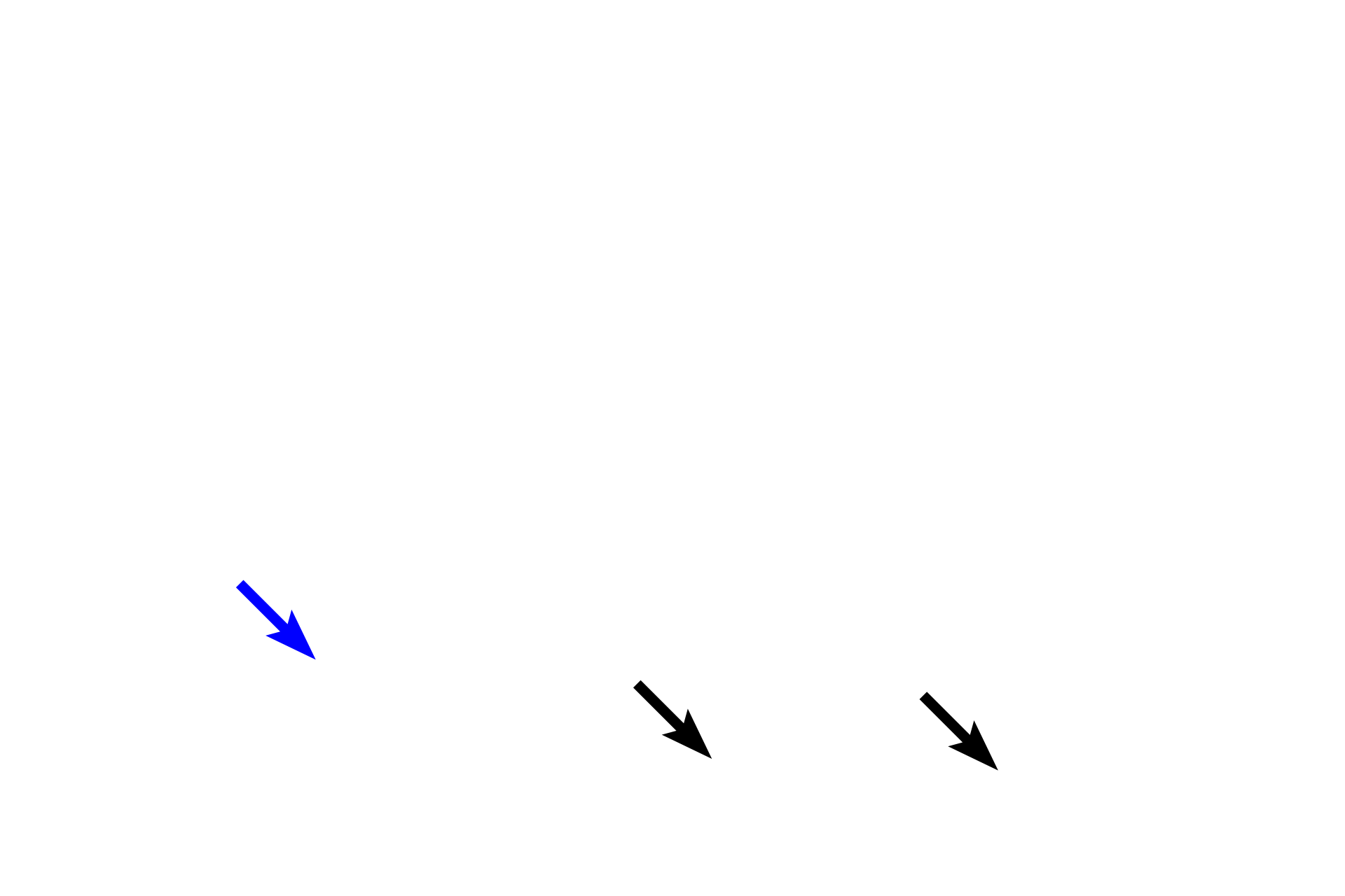  - Myofibrils > <p>Purkinje fibers have fewer myofibrils and they are mostly confined to the periphery of the cell. This distribution is apparent in the cross-sectioned fiber (blue arrow). Myofilaments are present and the banding pattern of the myofibrils is similar to that in cardiac fibers.</p>
