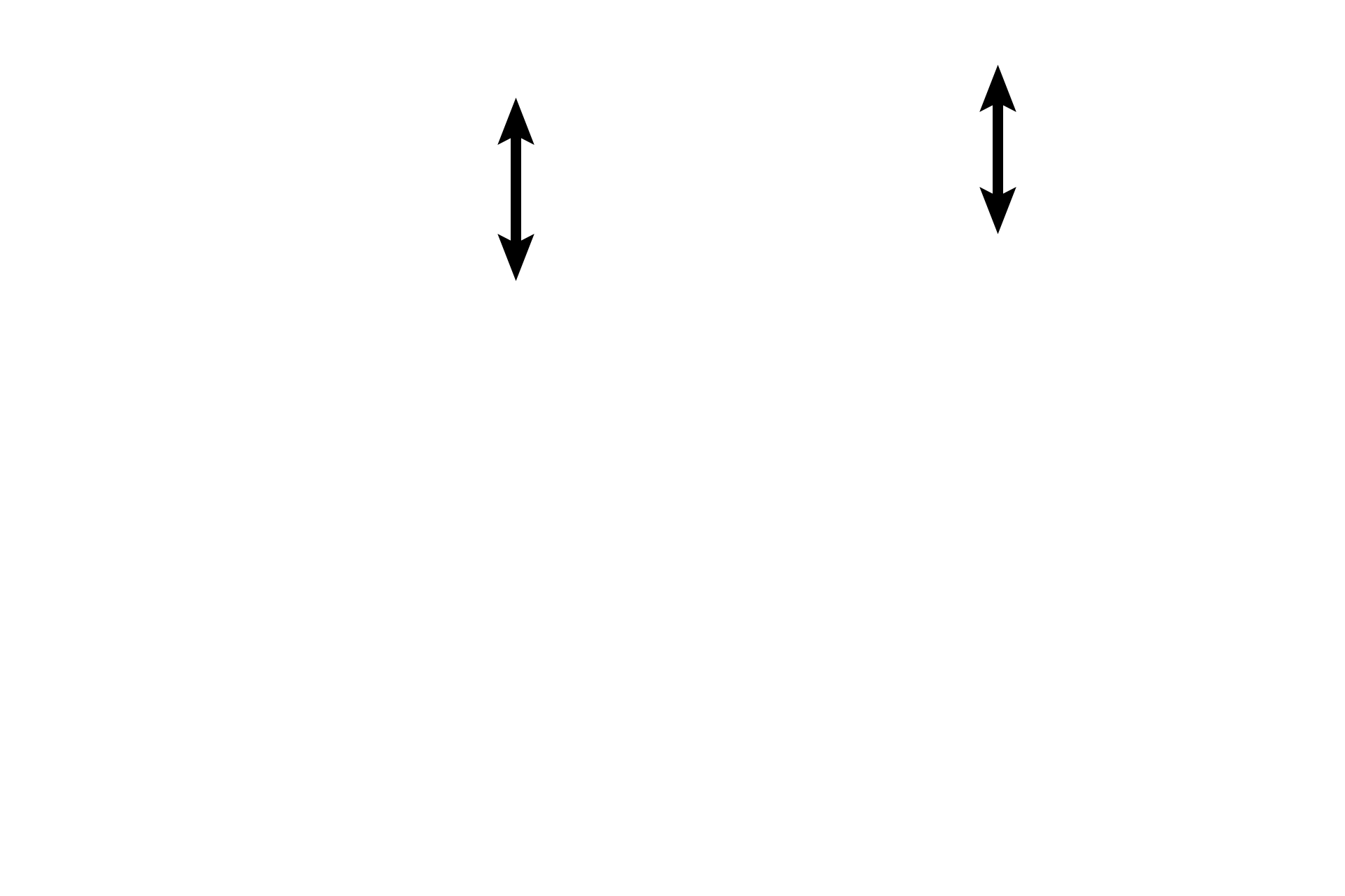 Endocardium > <p>The endocardium forms the inner layer of the heart and consists of an epithelium (endothelium), subendothelial connective tissue and a subendocardial layer.  Purkinje fibers are located in the subendocardial layer.</p>
