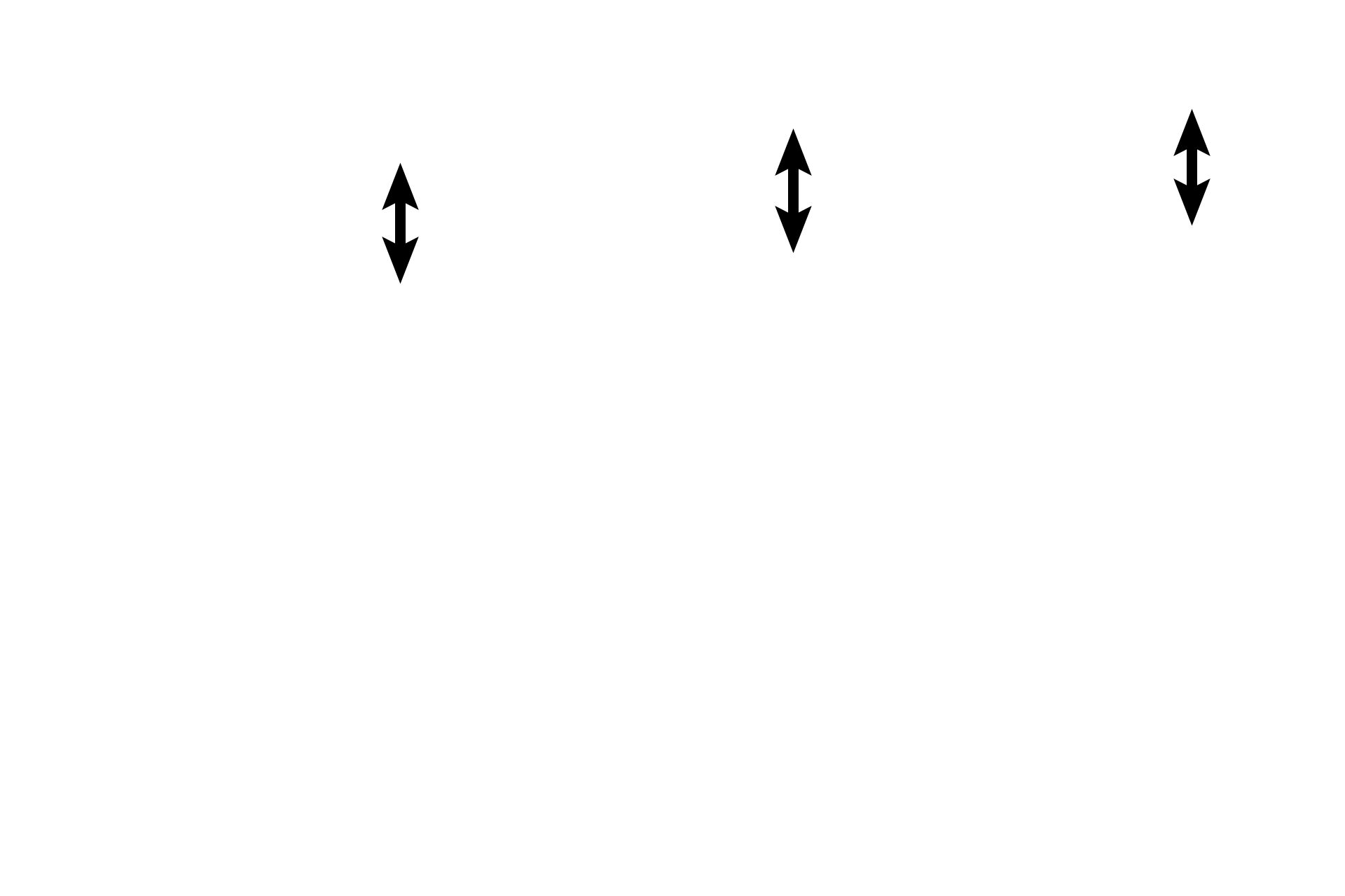  - Subendocardial layer <p>The endocardium forms the inner layer of the heart and consists of an epithelium (endothelium), subendothelial connective tissue and a subendocardial layer.  Purkinje fibers are located in the subendocardial layer.</p>
