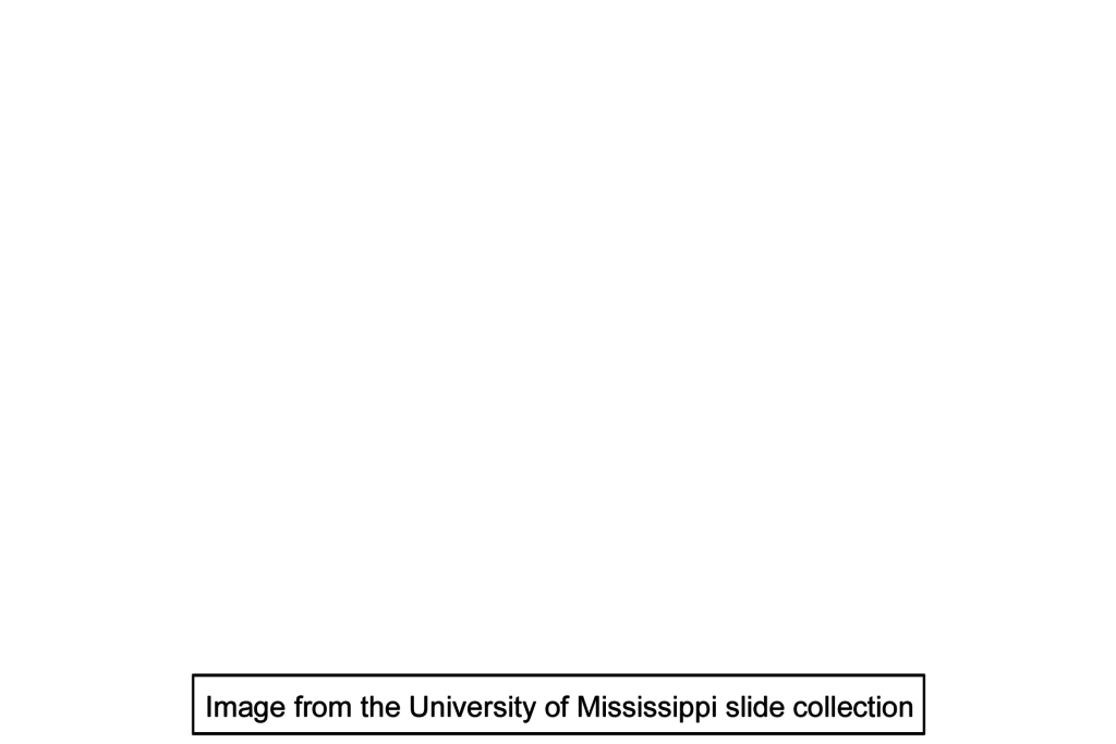 Image source > <p>This image was taken of slide in the University of Mississippi collection.</p>
