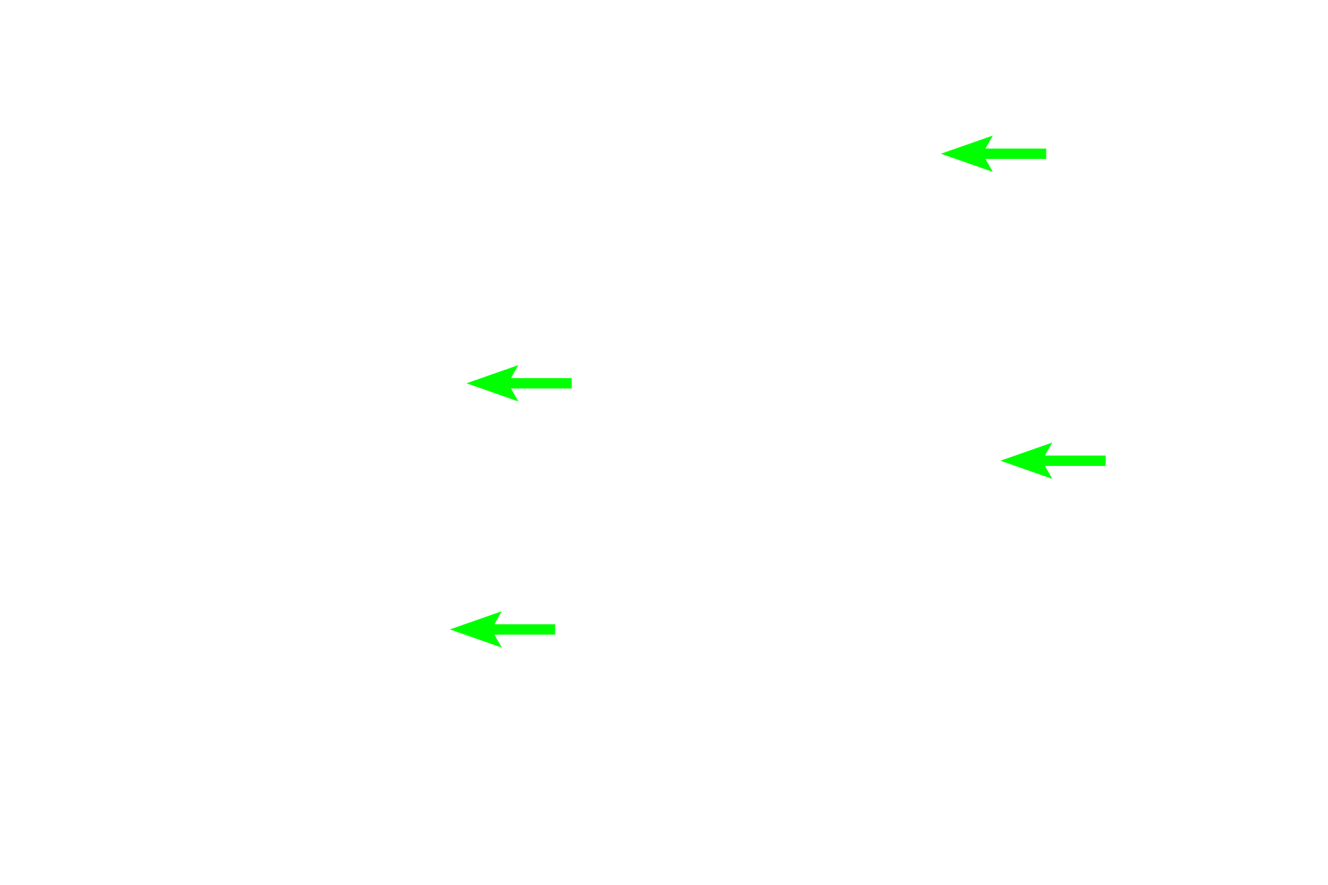  - Stereocilia <p>The epithelium of the duct of the epididymis consists of a pseudostratified columnar epithelium composed primarily of principal cells with tall stereocilia. Principle cells absorb luminal fluid thereby concentrating the sperm.  This epithelium decreases in height as the duct progresses from the head to the tail region.  600x</p>
