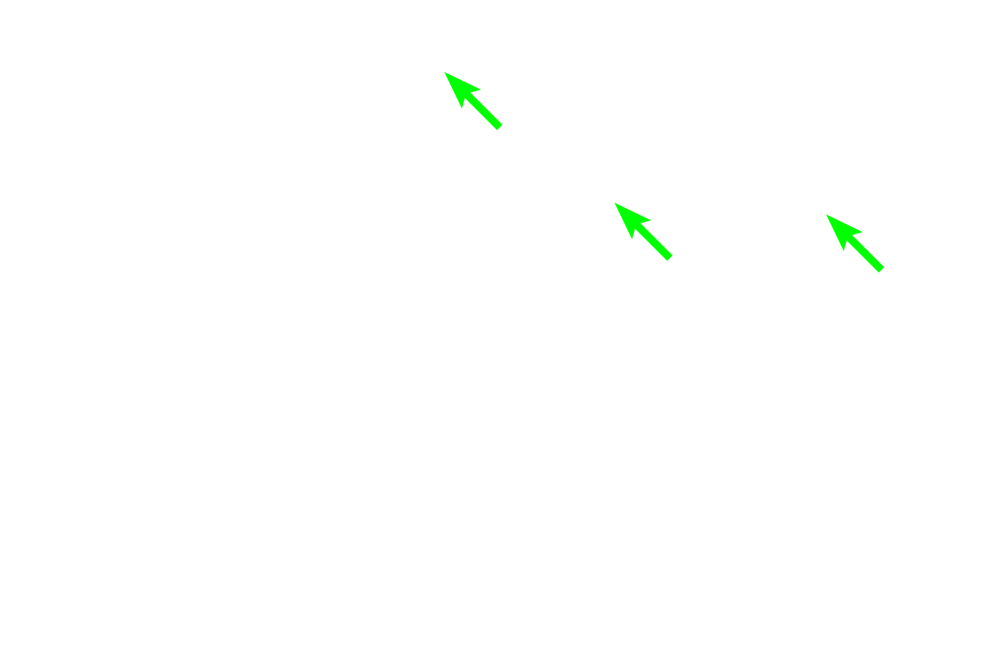  - Stereocilia <p>The duct of the epididymis is lined by pseudostratified columnar epithelium with stereocilia.  Junctional complexes, visible in the apical regions of these cells, provide a tight seal from the luminal contents.  As the duct progresses from the head to the tail region, the epithelium decreases in height and the layer of smooth increases in thickness, gaining additional layers from head to tail. 1000x </p>
