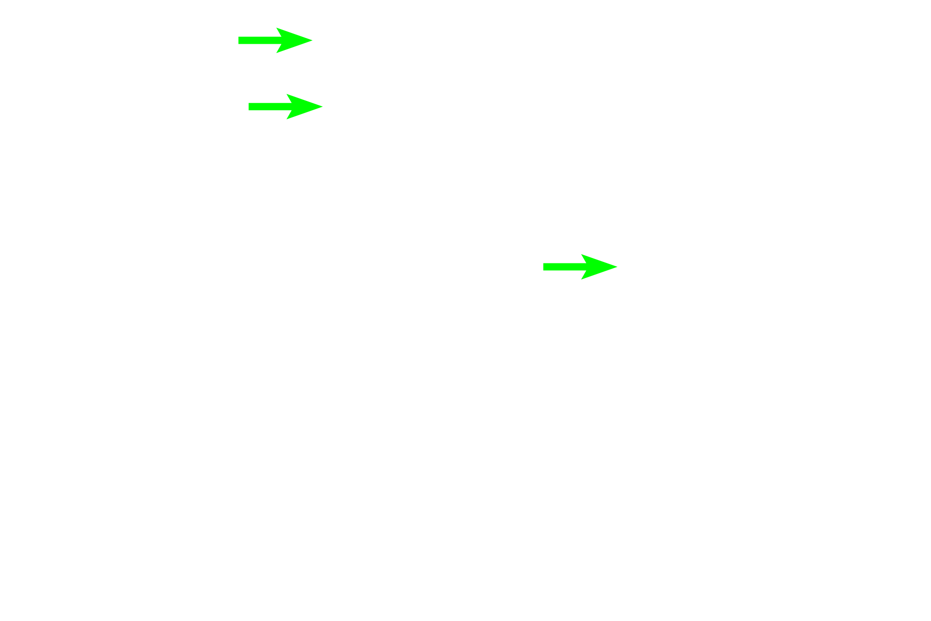  - Junctional complexes > <p>Junctional complexes, composed of zonula occludens, zonula adherens and desmosomes, serve to seal the surface of the epithelium and attach the cells together.  By light microscopy, these junctional complexes are often referred to as a terminal bars.  </p>
