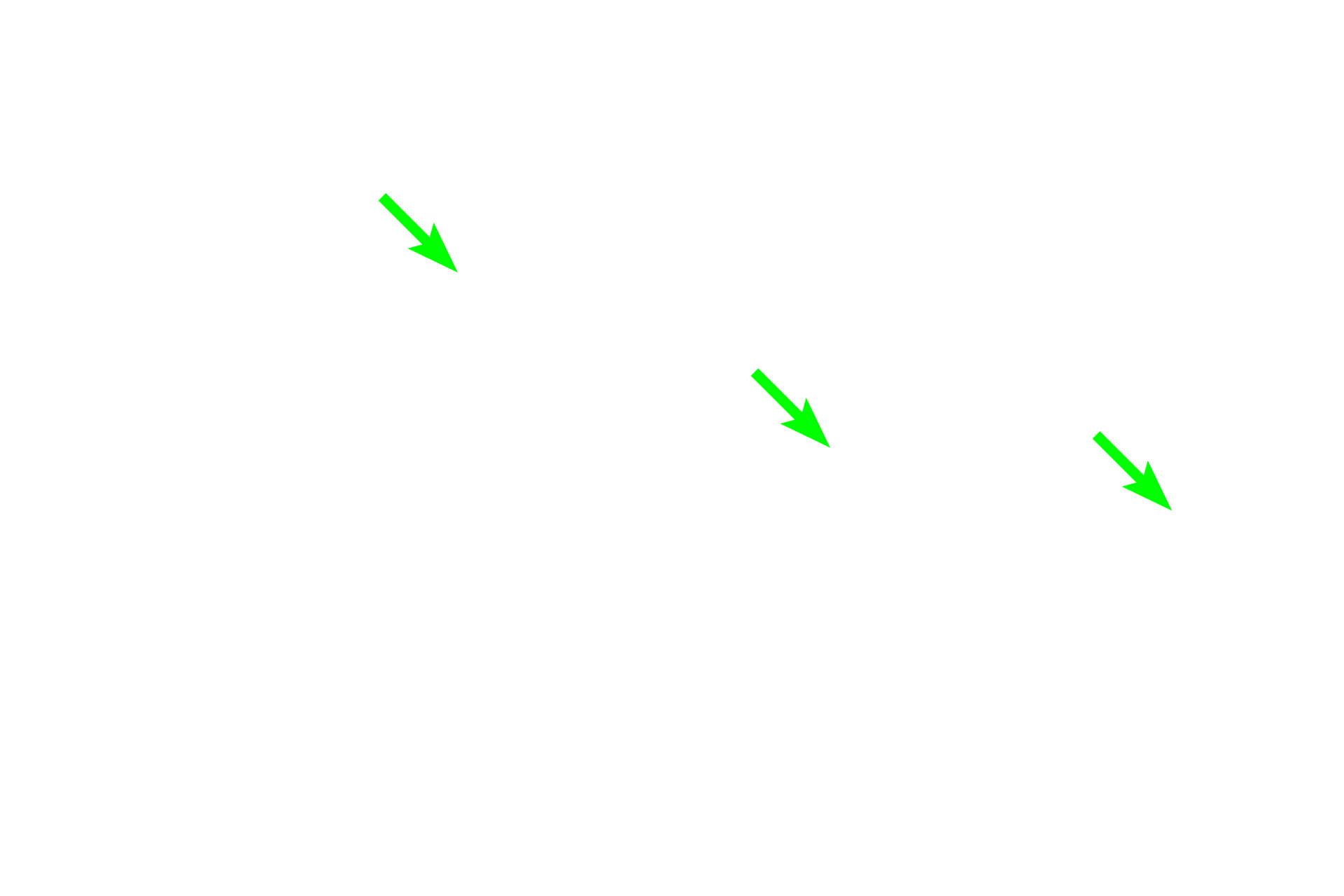  - Migrating cells > <p>The epithelium also contains a variety migratory immune cells including macrophages, lymphocytes and monocytes.  Among these cells are suppressor T cells to prevent the development of an immune response to auto-antigens on spermatozoa.</p>
