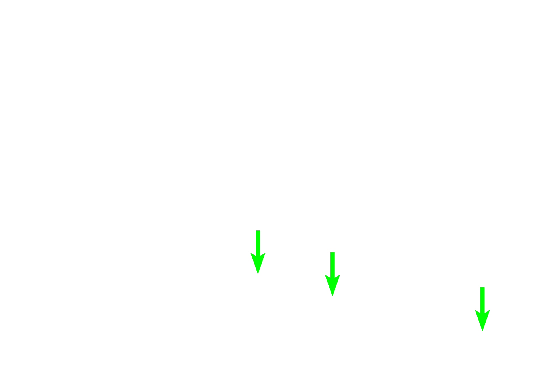  - Basal cells > <p>Basal cells are small, round basal cells that rest on the basement membrane and serve as stem cells for the epithelium.</p>
