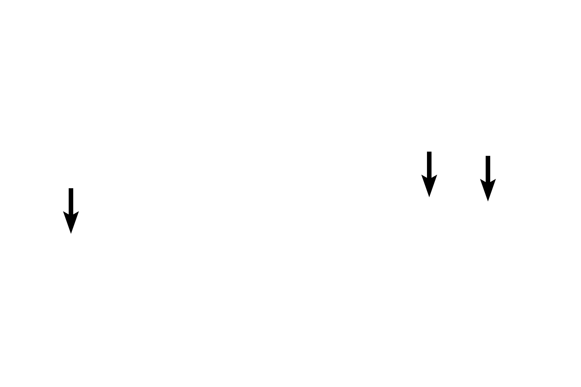 Peripheral nuclei <p>Closely spaced myofibrils almost totally fill the cytoplasm of skeletal muscle fibers, and thus are not normally visible individually.  A region of artifactual separation in the upper fiber reveals individual myofibrils as well as the banding pattern present in each.  In other regions of the section, the myofibrils remain tightly compacted and their alignment results in the banding seen across the entire muscle fiber.  1000x</p>
