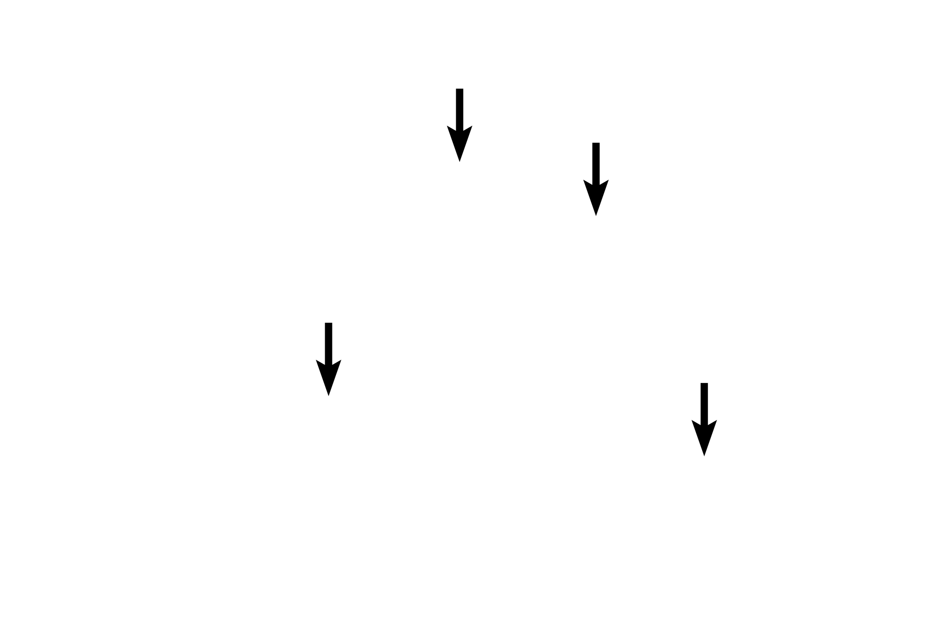 A bands <p>Closely spaced myofibrils almost totally fill the cytoplasm of skeletal muscle fibers, and thus are not normally visible individually.  A region of artifactual separation in the upper fiber reveals individual myofibrils as well as the banding pattern present in each.  In other regions of the section, the myofibrils remain tightly compacted and their alignment results in the banding seen across the entire muscle fiber.  1000x</p>
