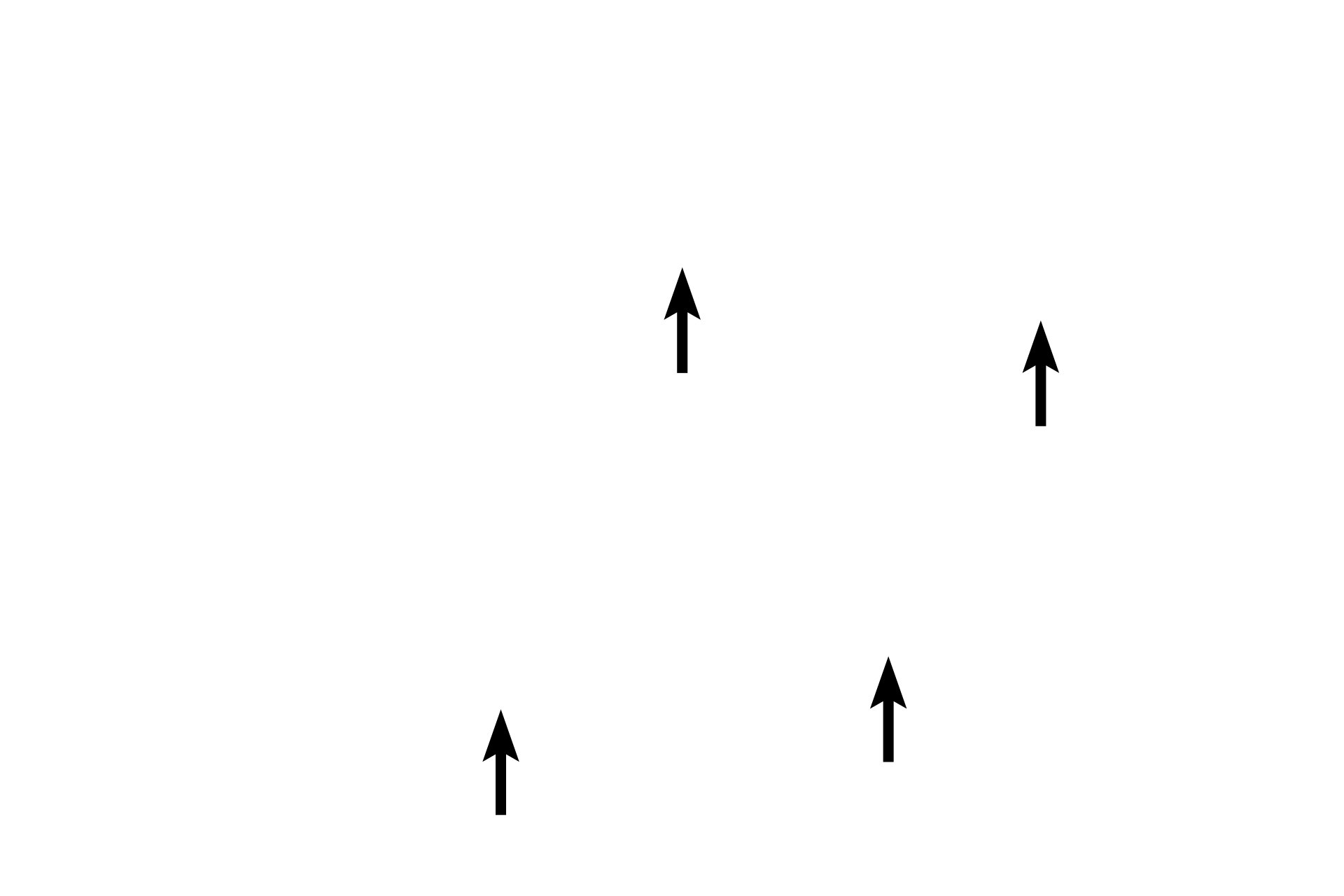 I bands <p>Closely spaced myofibrils almost totally fill the cytoplasm of skeletal muscle fibers, and thus are not normally visible individually.  A region of artifactual separation in the upper fiber reveals individual myofibrils as well as the banding pattern present in each.  In other regions of the section, the myofibrils remain tightly compacted and their alignment results in the banding seen across the entire muscle fiber.  1000x</p>
