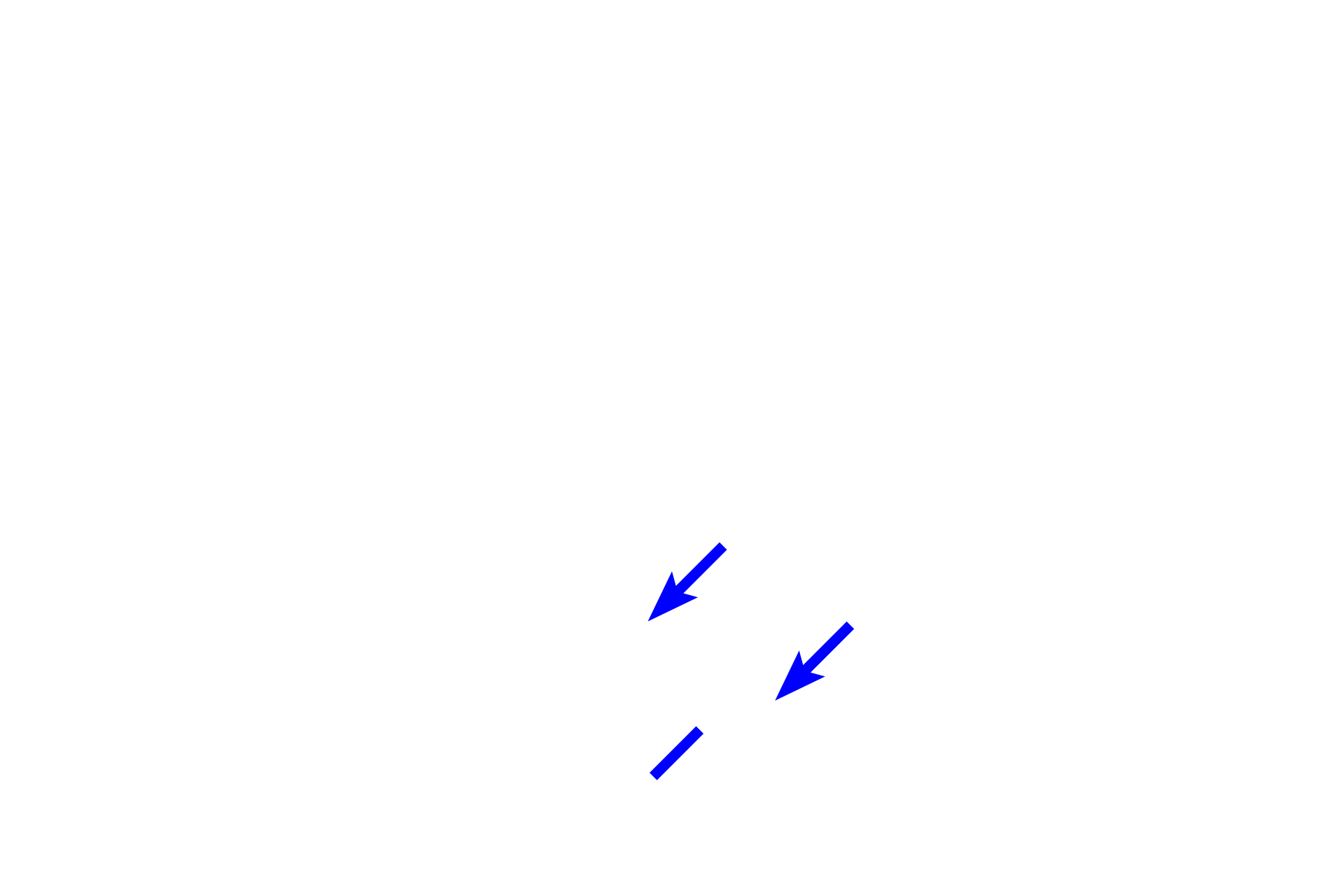  -- Cellular cementum <p>Cellular cementum contains cells (cementocytes) and is present on the apical one-third of the root.  It is thicker than acellular cementum and produced throughout life in response to force or trauma.</p>
