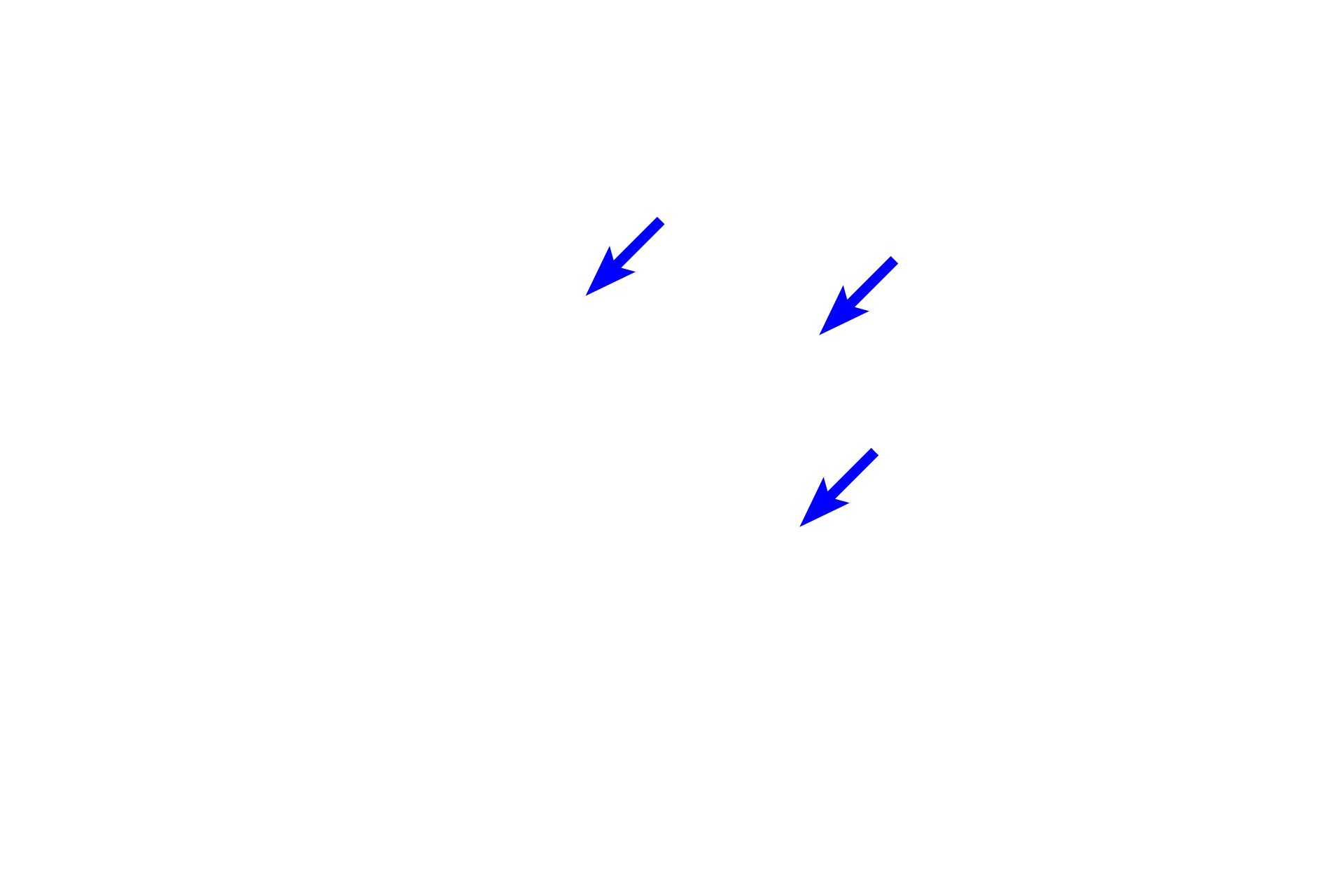  -- Acellular cementum <p>Acellular cementum is a thin layer of mineralized tissue on the surface of the cervical two-thirds of the root.  It is the first cementum and does not contain cells. </p>
