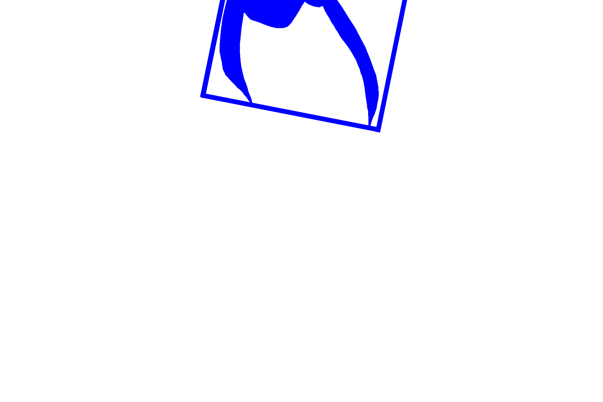  - Crown > <p>The crown of the tooth extends above the gum line and is covered by enamel.  Enamel is not retained in this section as a result of the decalcification process used during tissue preparation.  The position of the enamel in indicated by the blue shaded region.</p>
